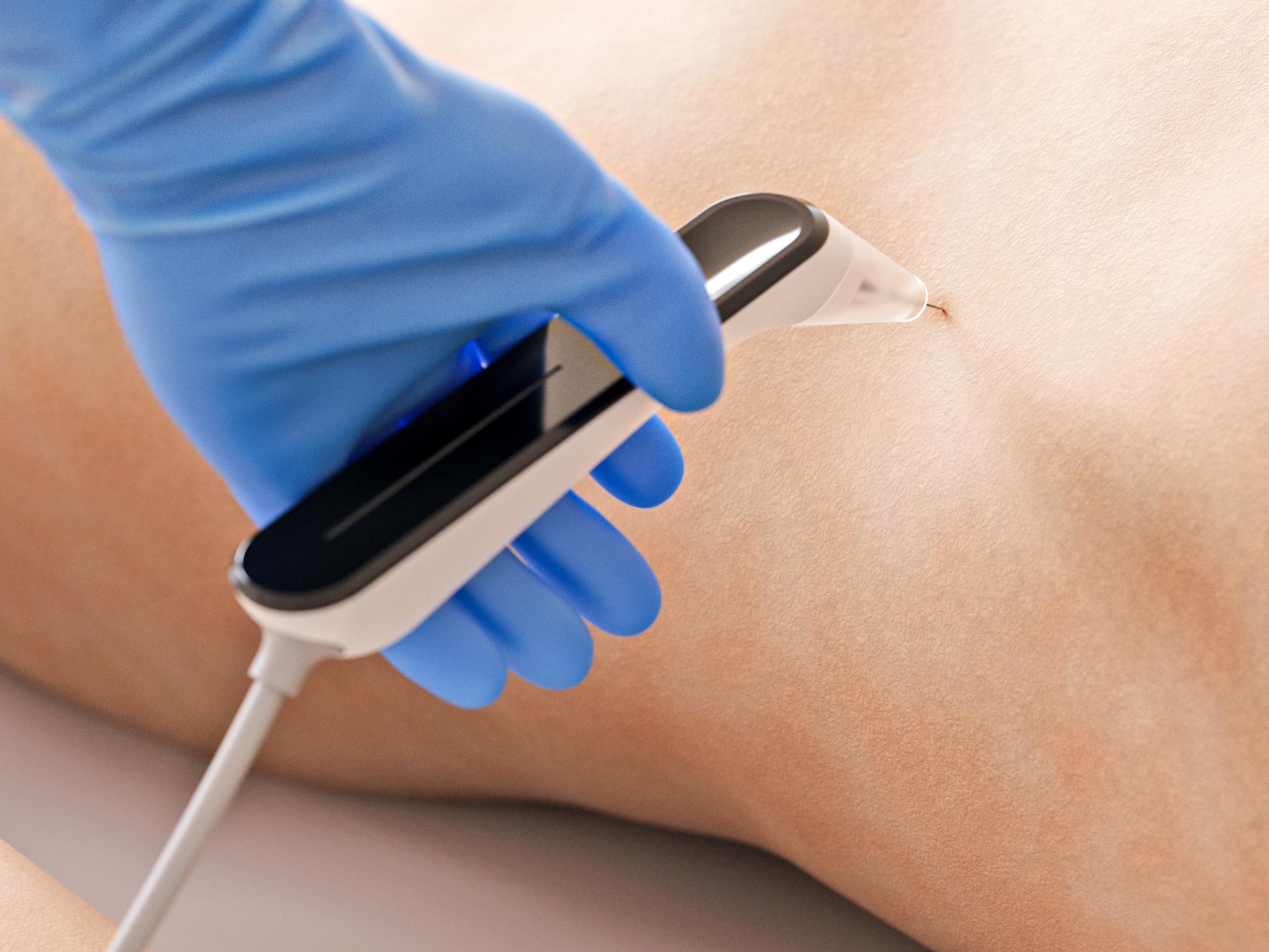 Hummingbird: Early-stage Diagnostics Tool