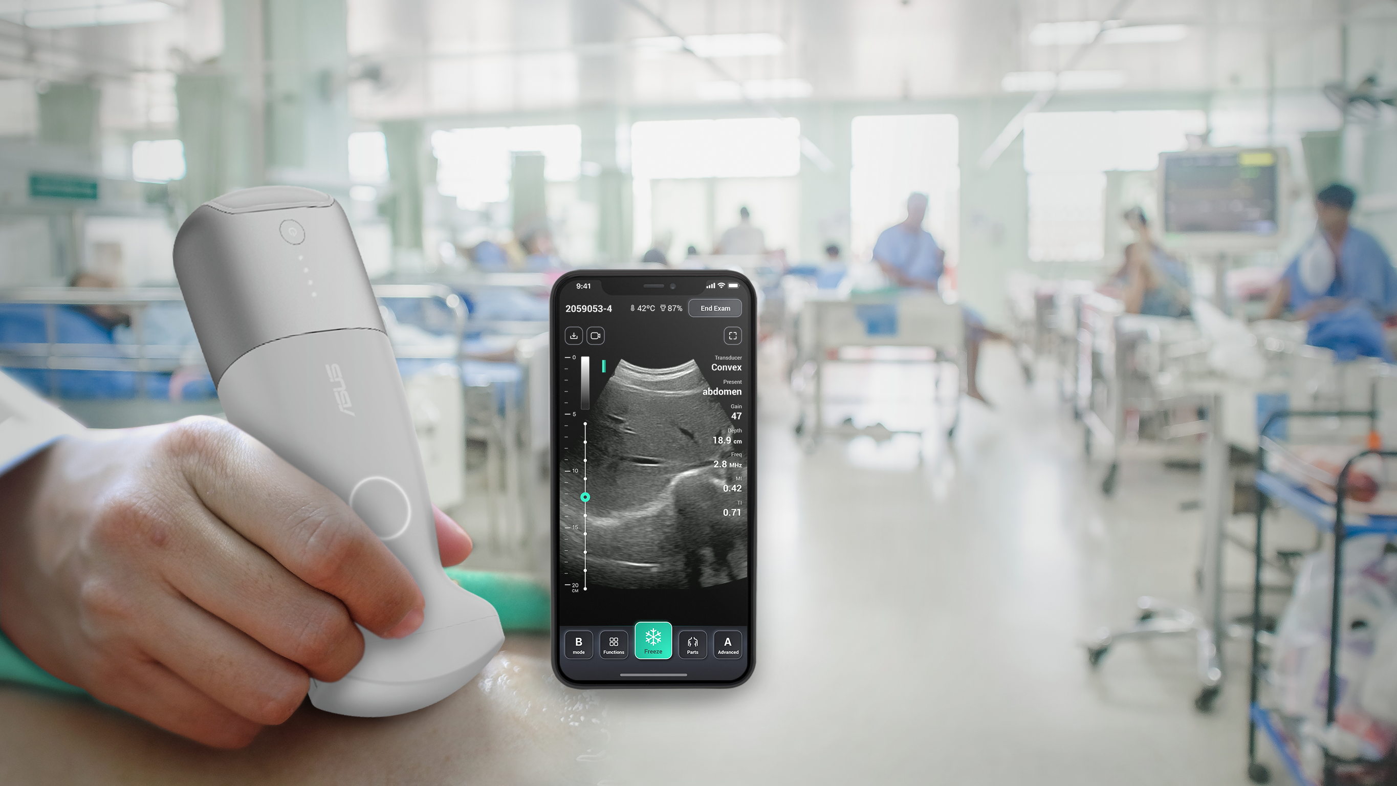 ASUS portable ultrasound solution