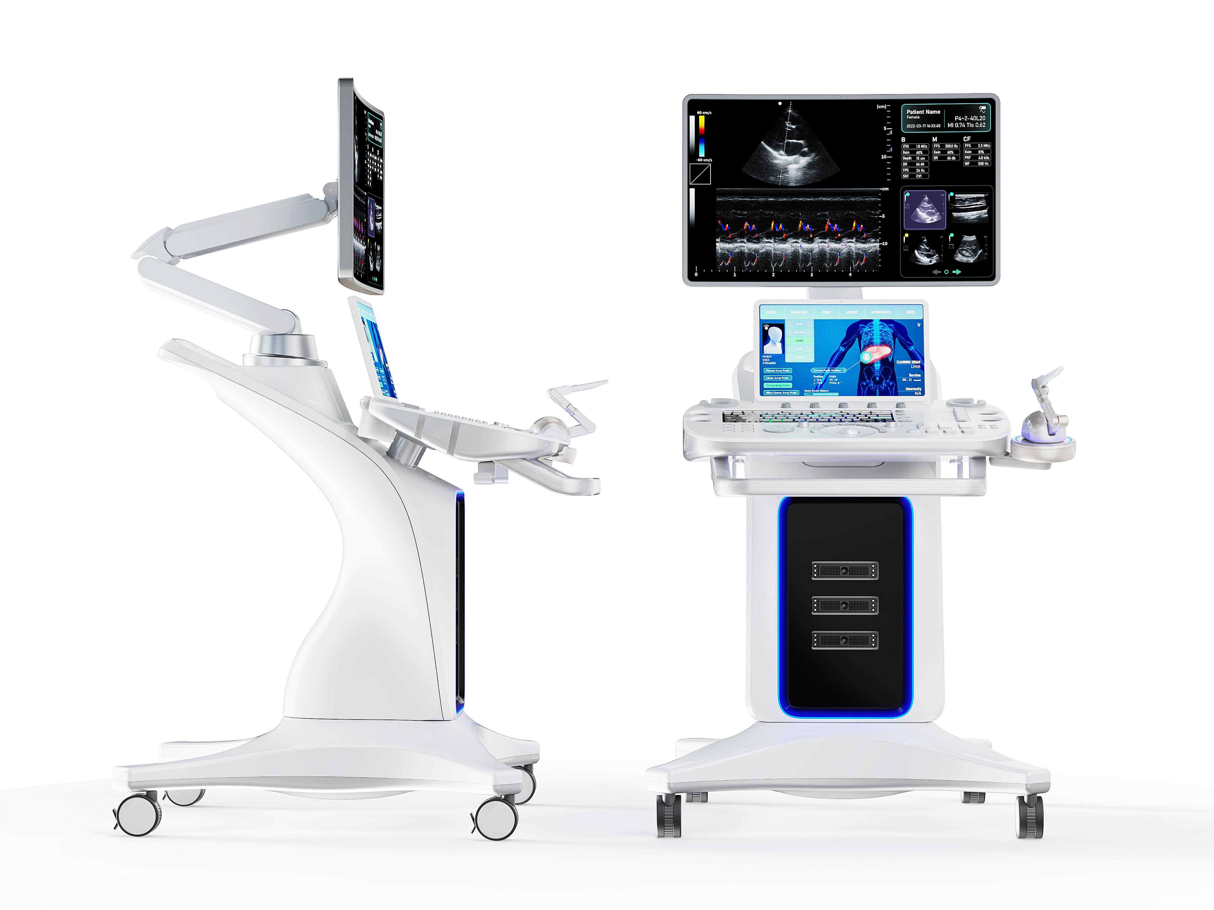 Remoltra Remote Ultrasound Diagnostic System
