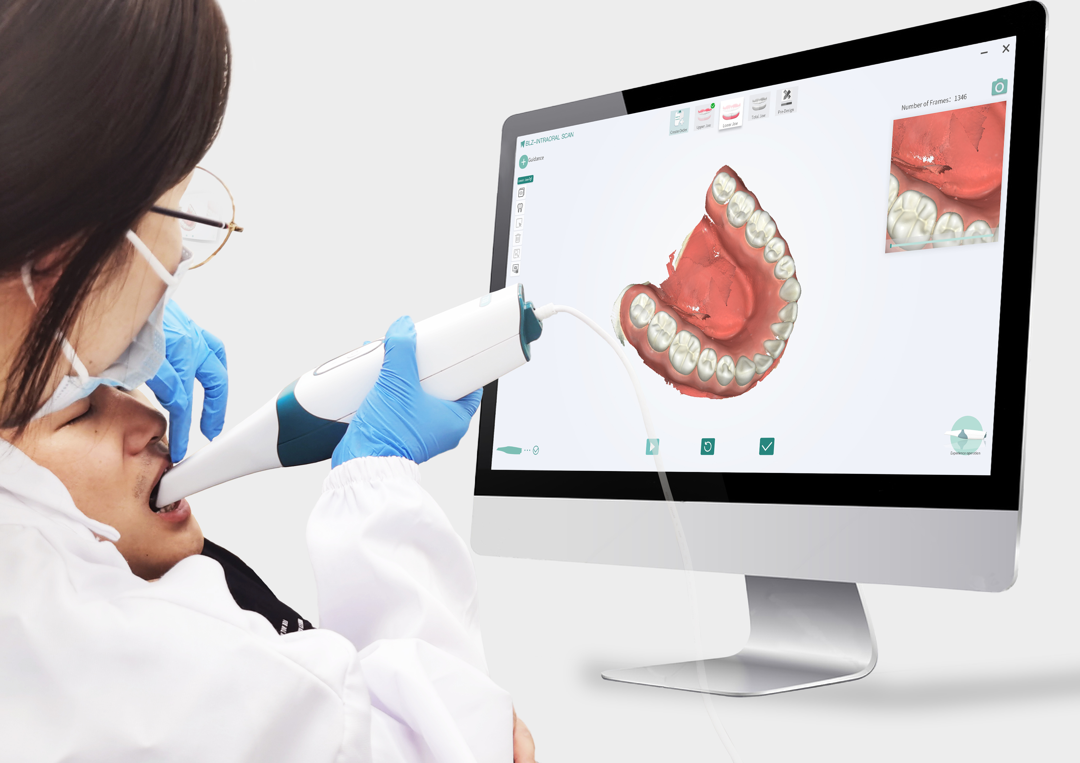 INO100 Intraoral Scanner User Experience System