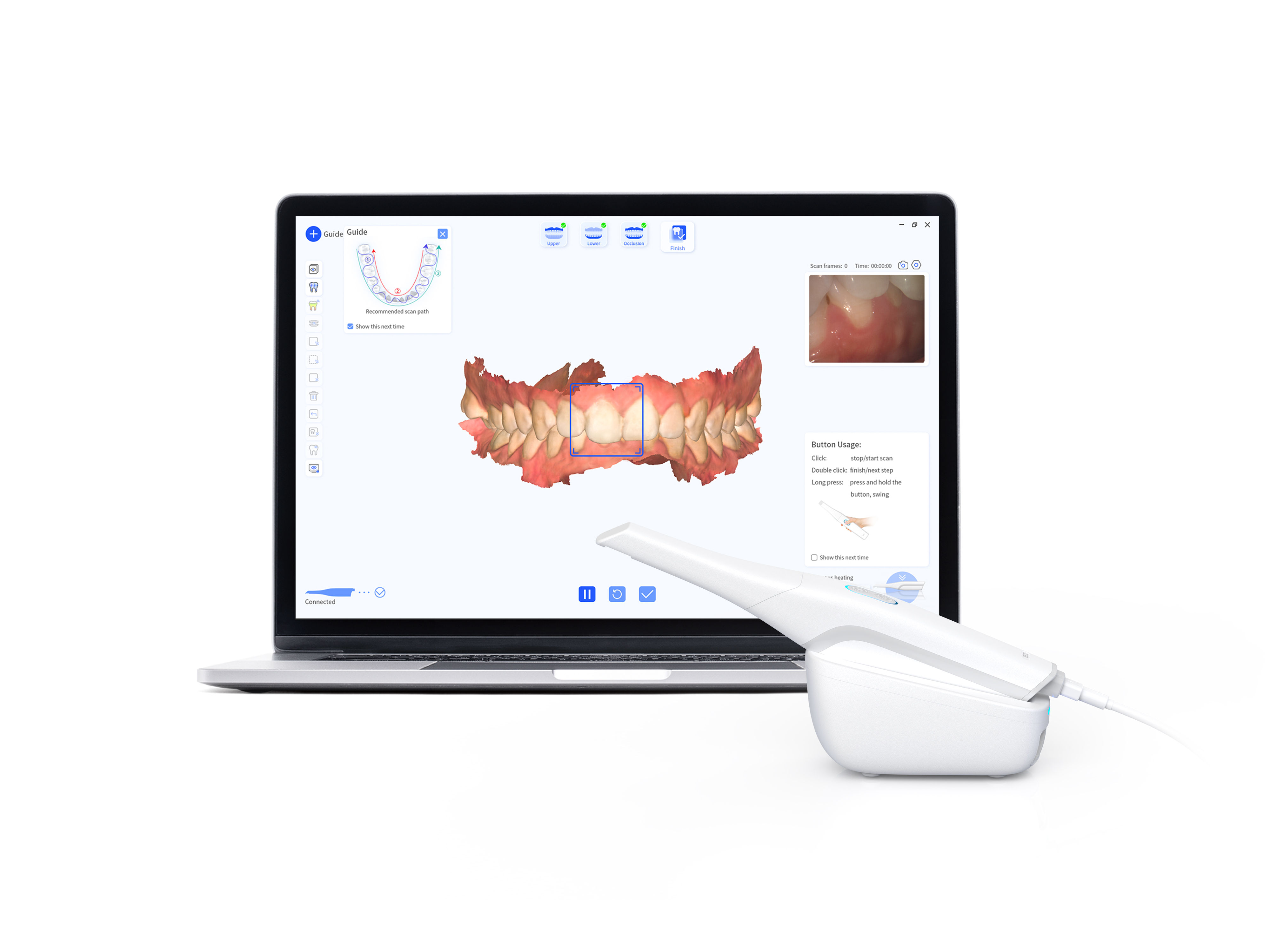 INO200 Intraoral Scanner User Experience System