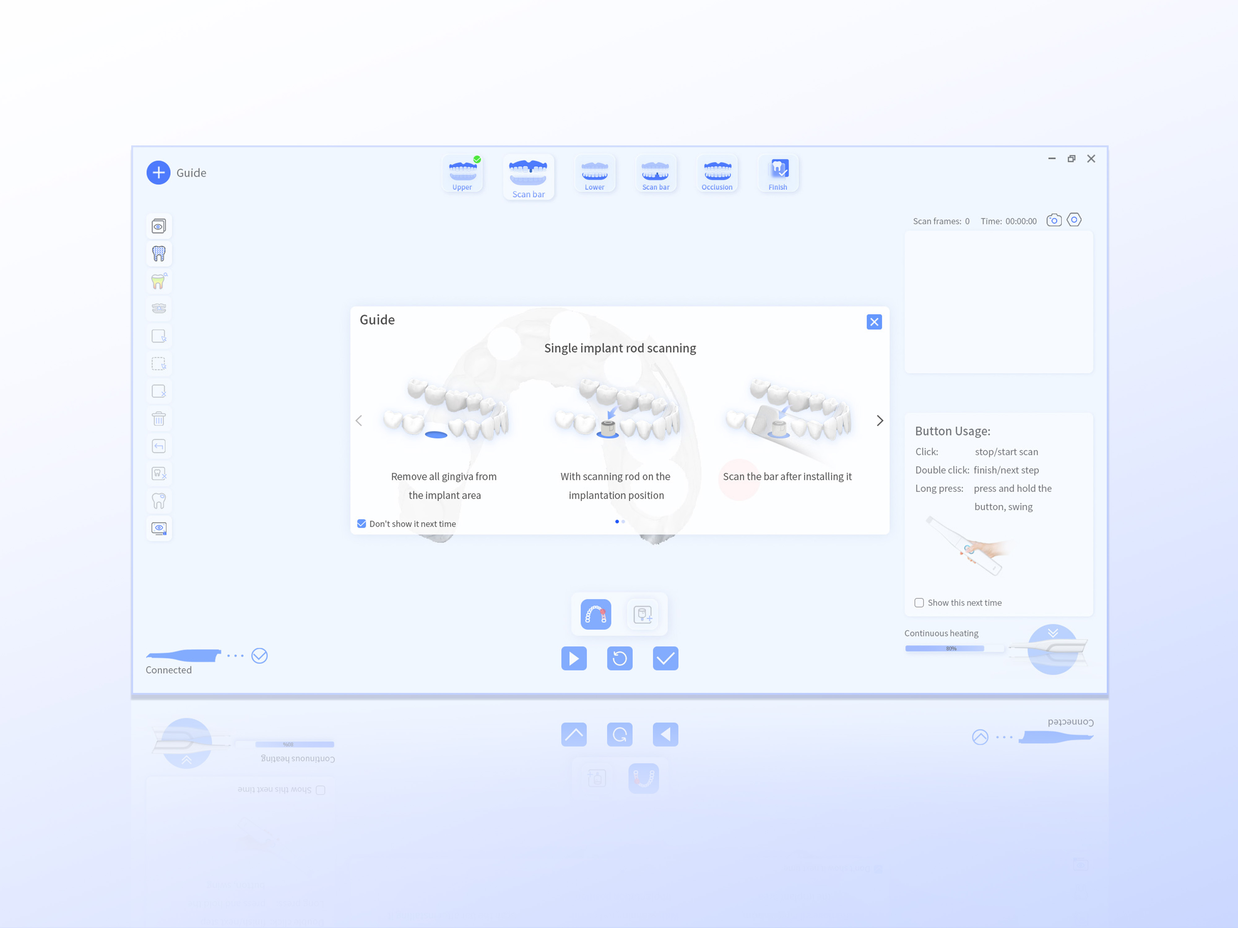 INO200 Intraoral Scanner User Experience System