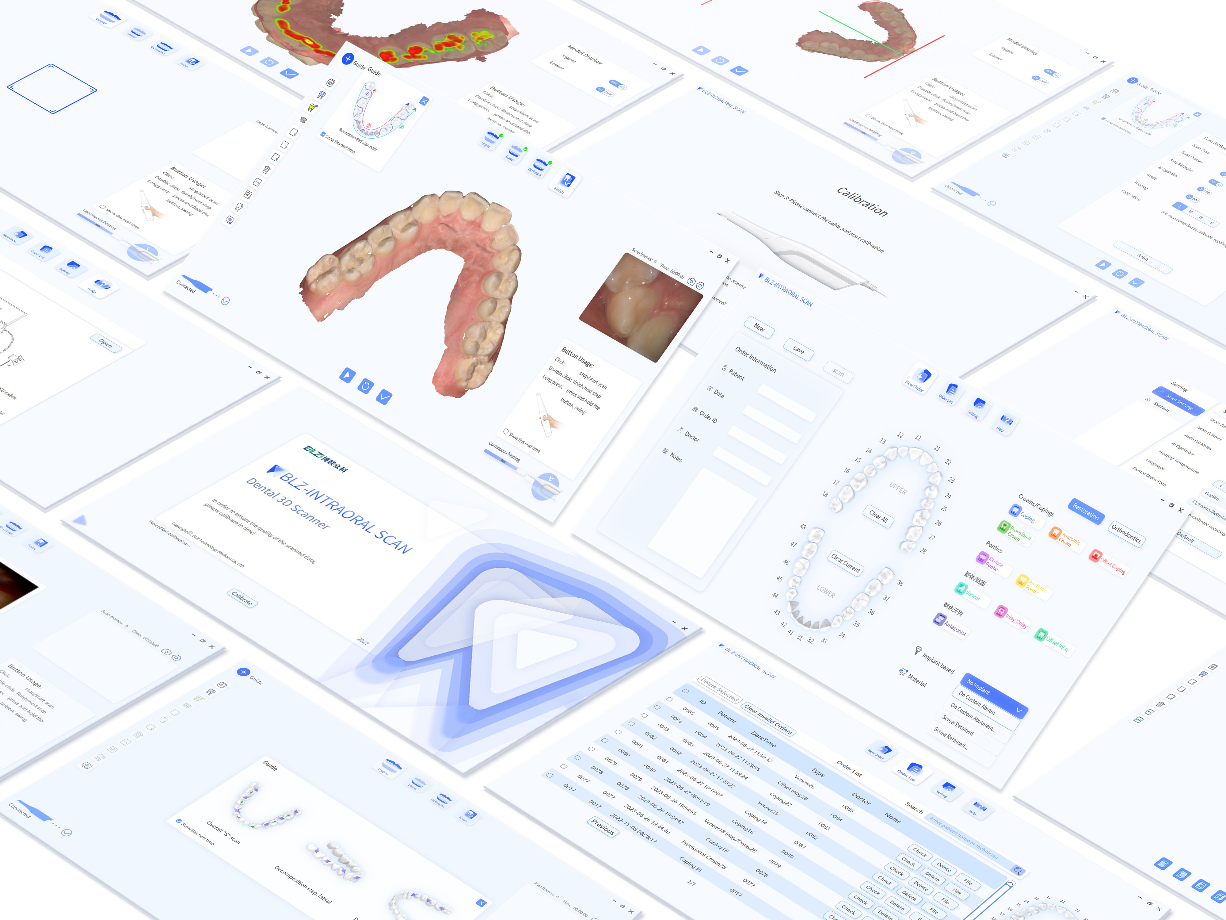 INO200 Intraoral Scanner User Experience System