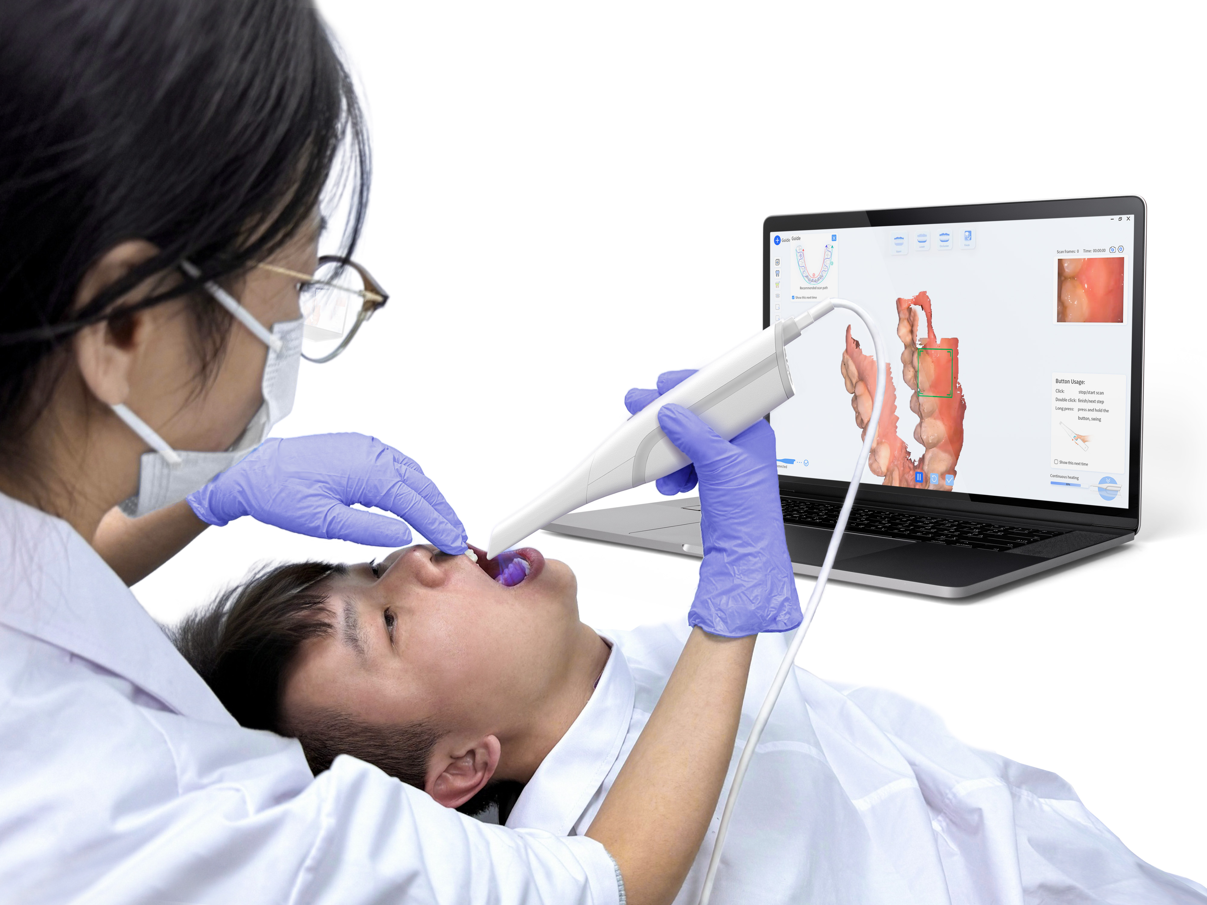 INO200 Intraoral Scanner User Experience System