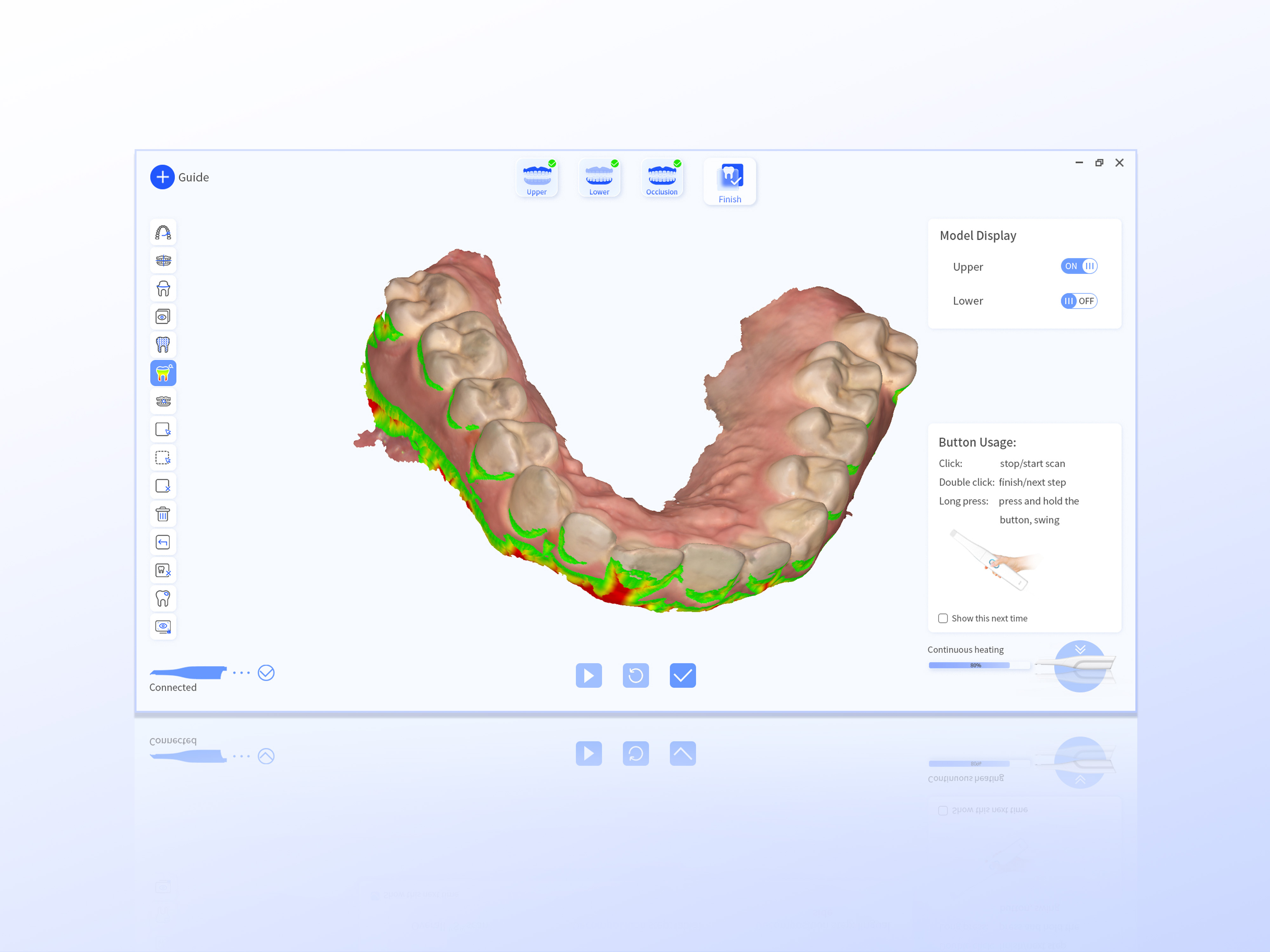 INO200 Intraoral Scanner User Experience System