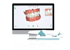 INO100 Intraoral Scanner User Experience System