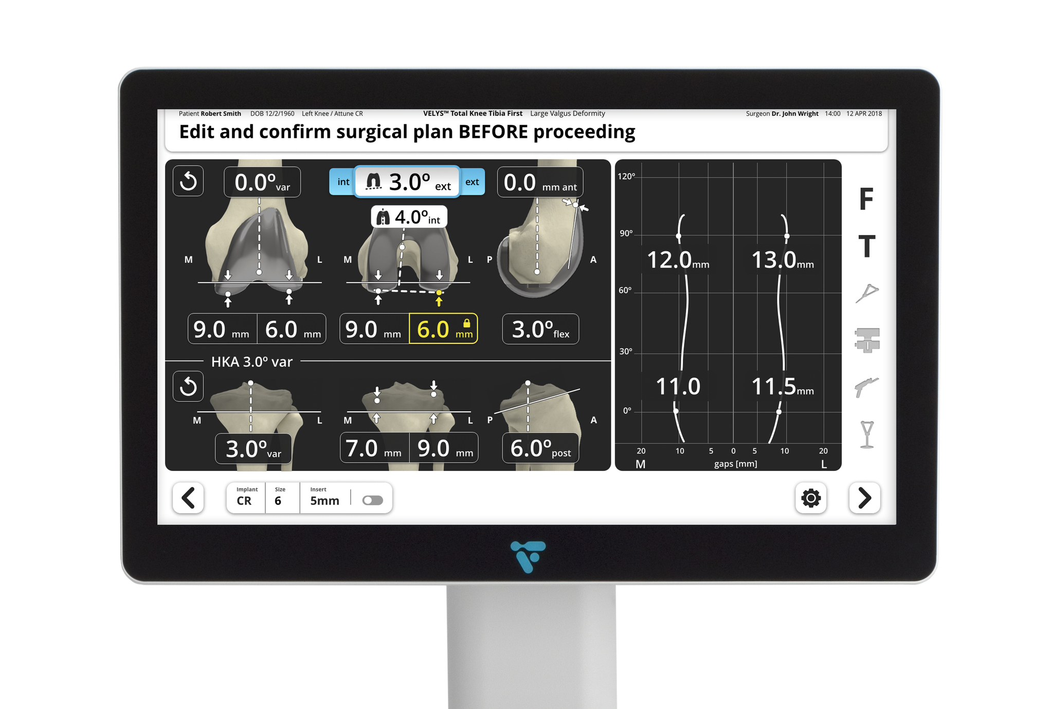 VELYS Robotic-Assisted Solution