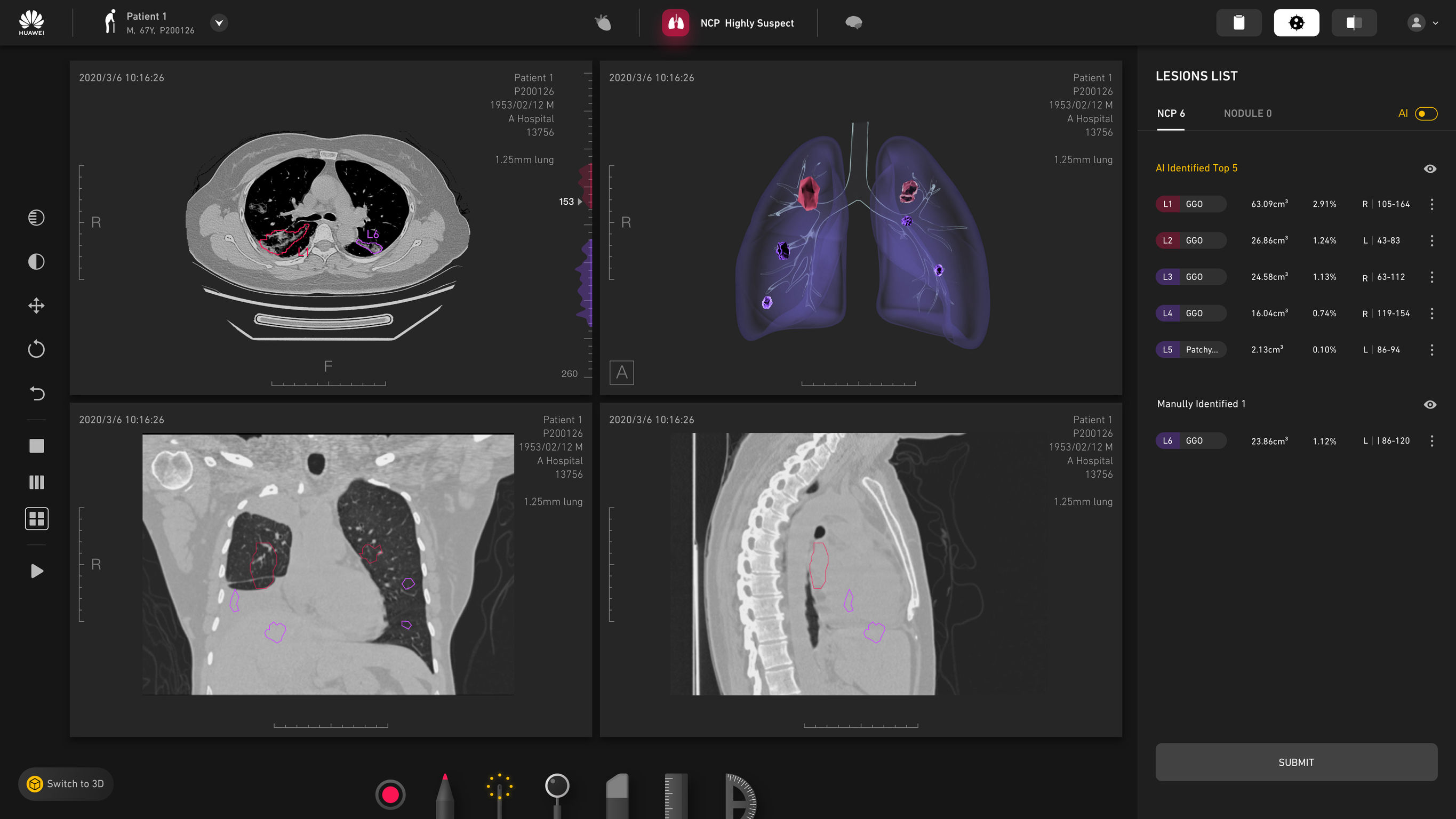 HUAWEI SMART MEDICAL IMAGING | AI