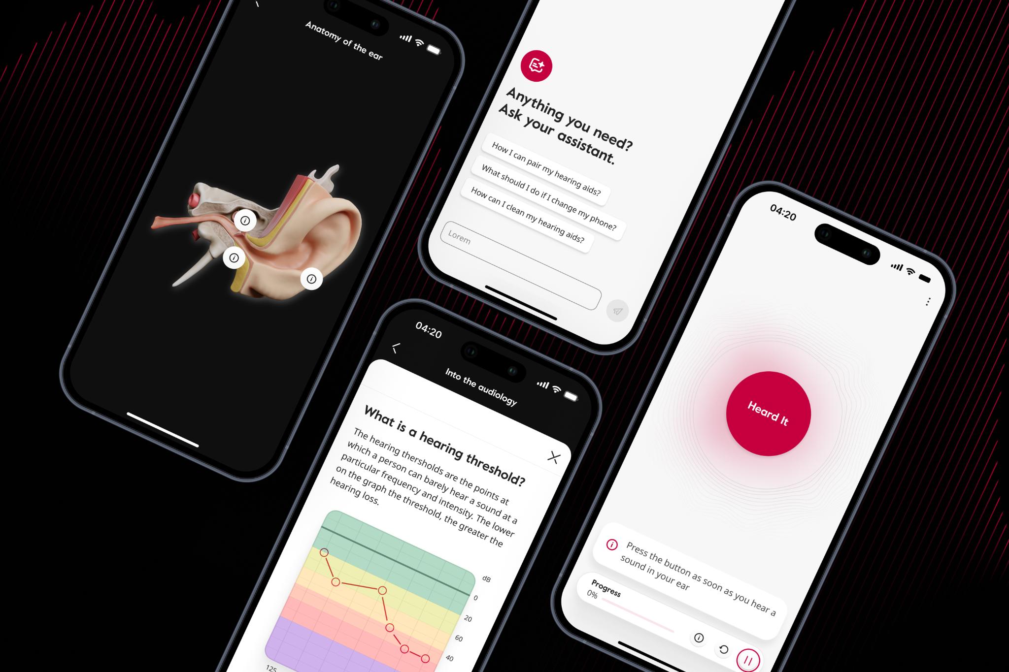 Amplifon App