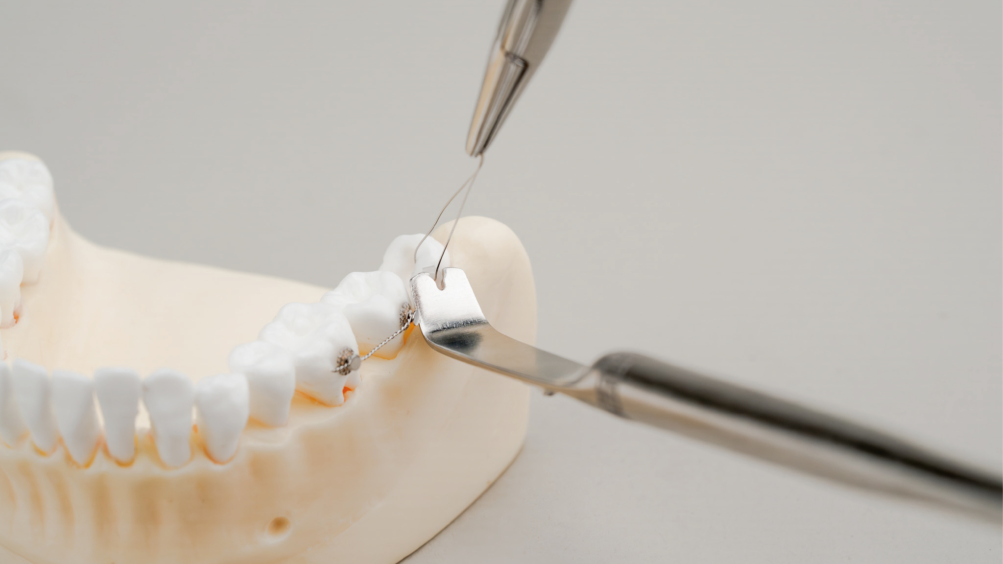 Kyola Distraction Retractor (KDR)