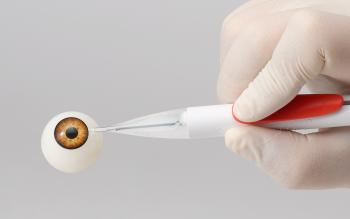 Ophthalmic cataract surgery device - imass