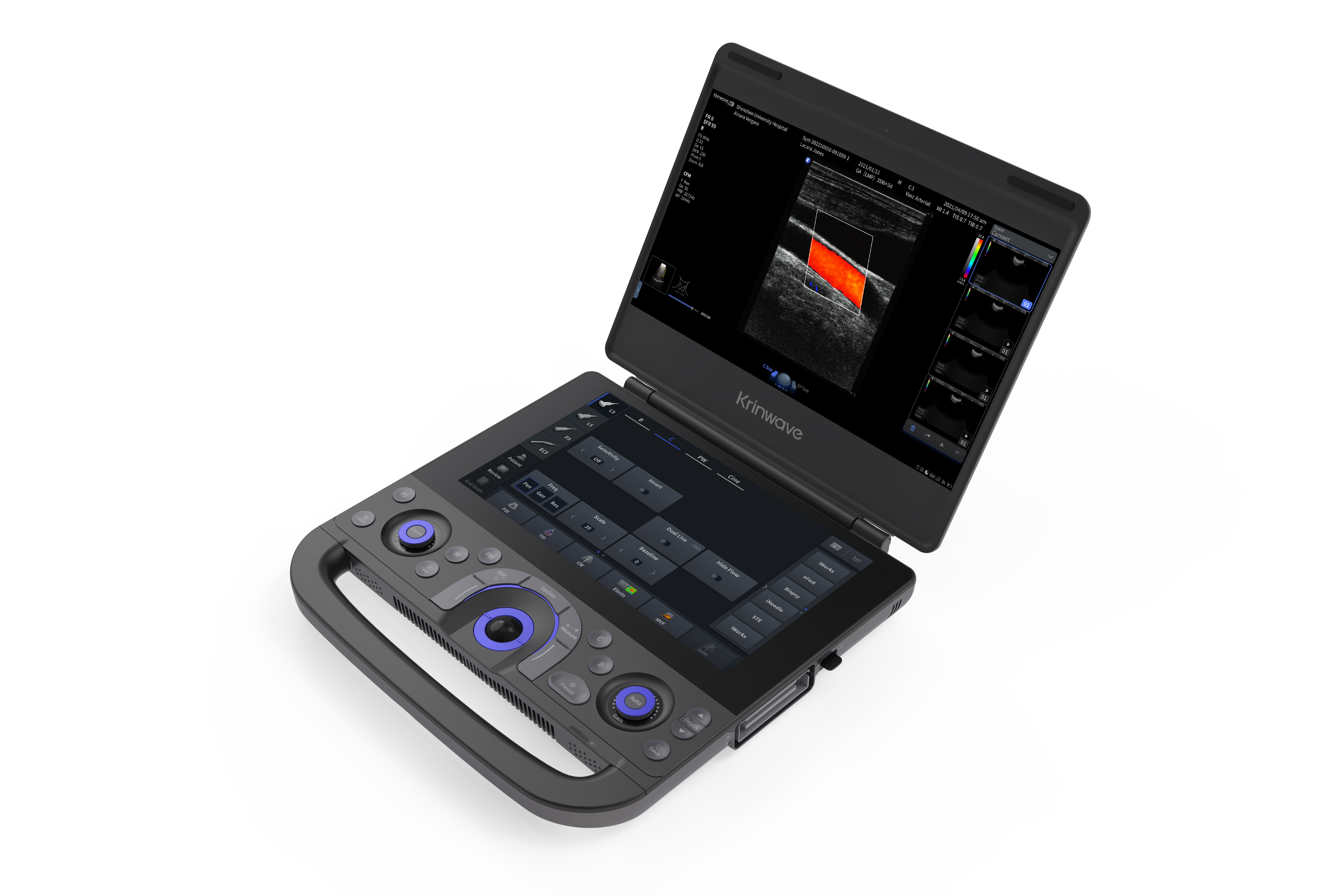 WE9 Diagnostic Ultrasound System