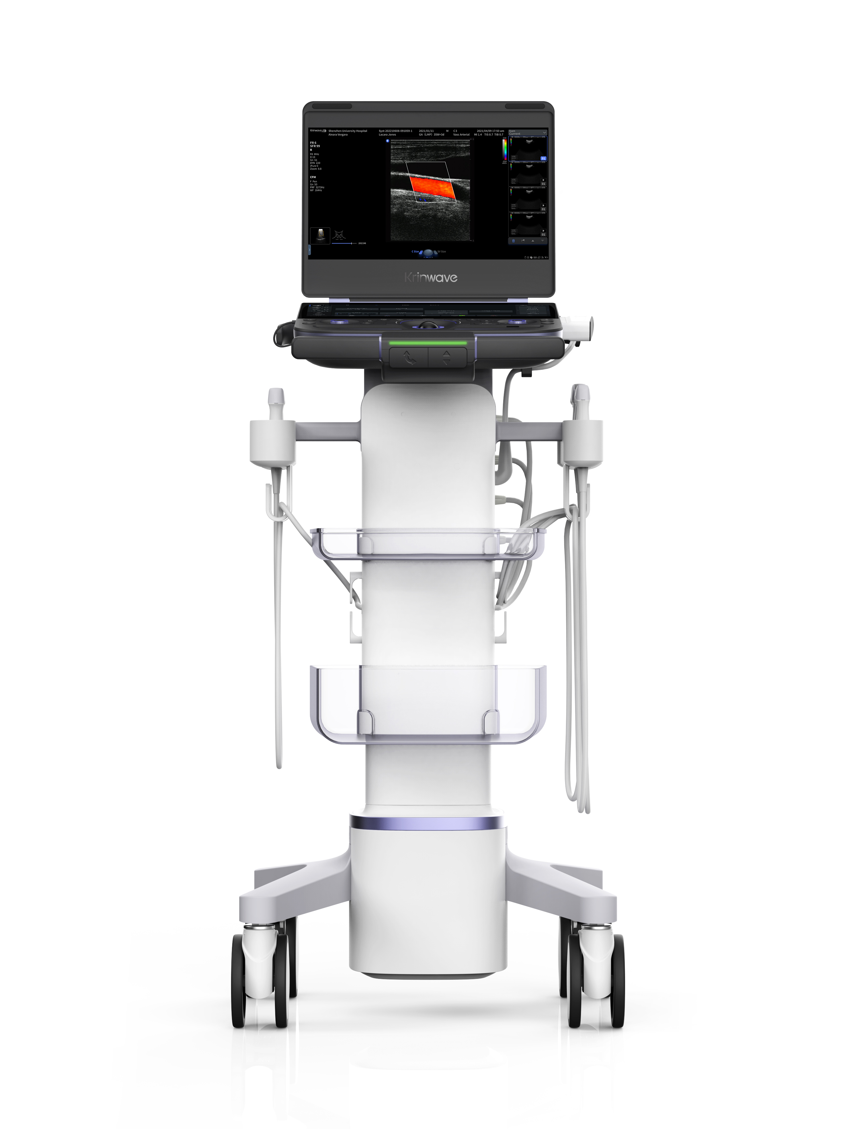 WE9 Diagnostic Ultrasound System