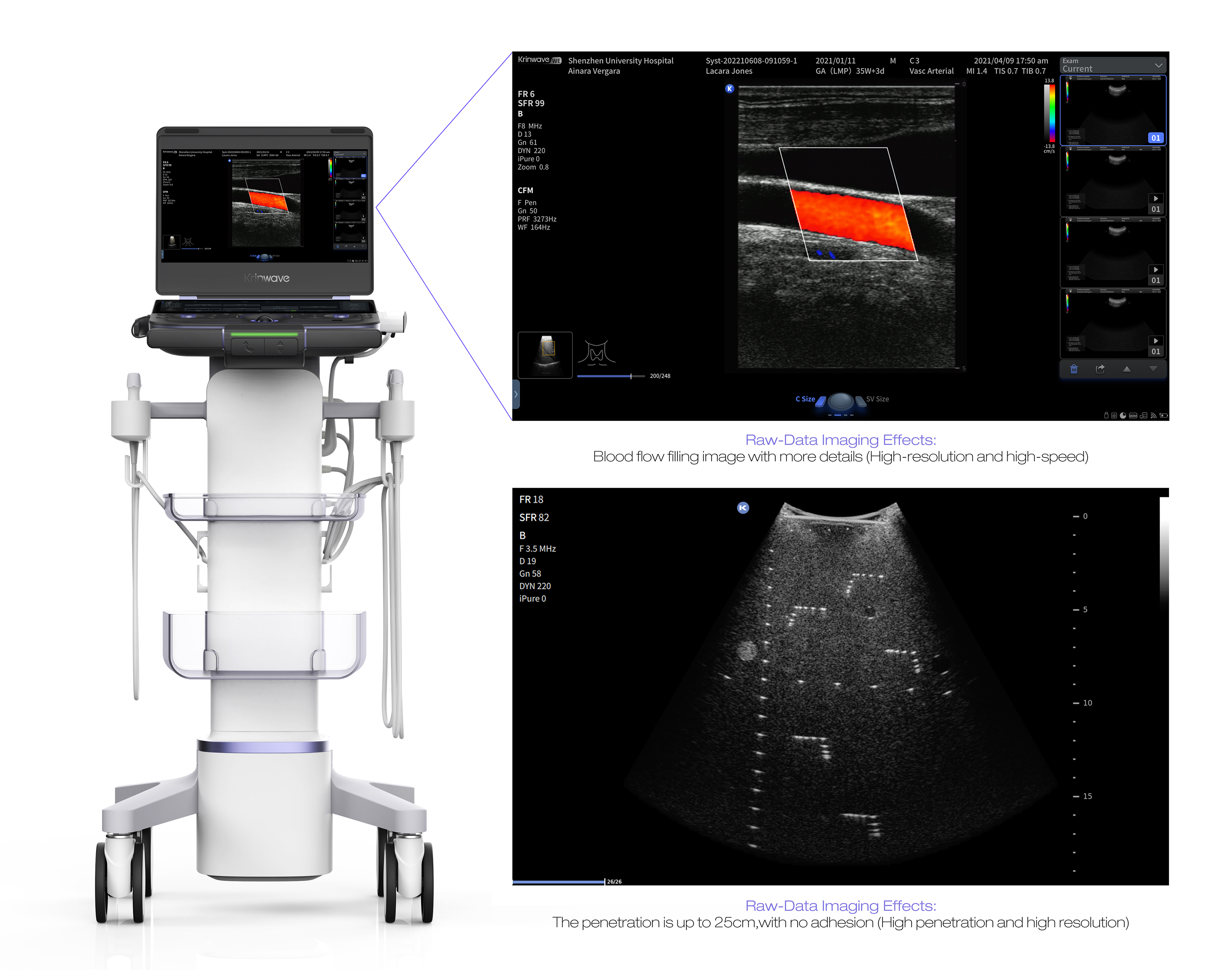WE9 Diagnostic Ultrasound System
