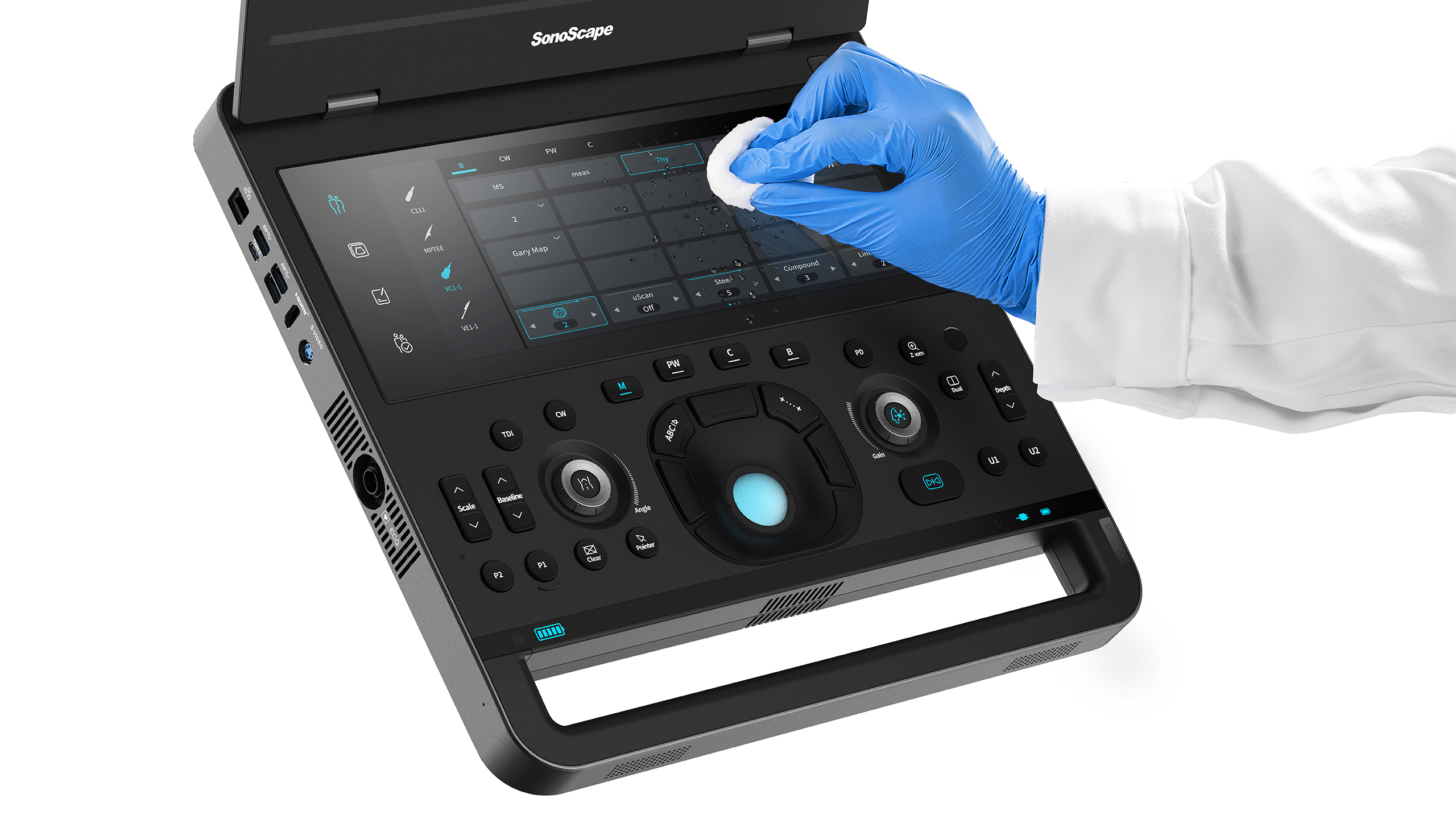 SonoScape Portable Ultrasound X-Series