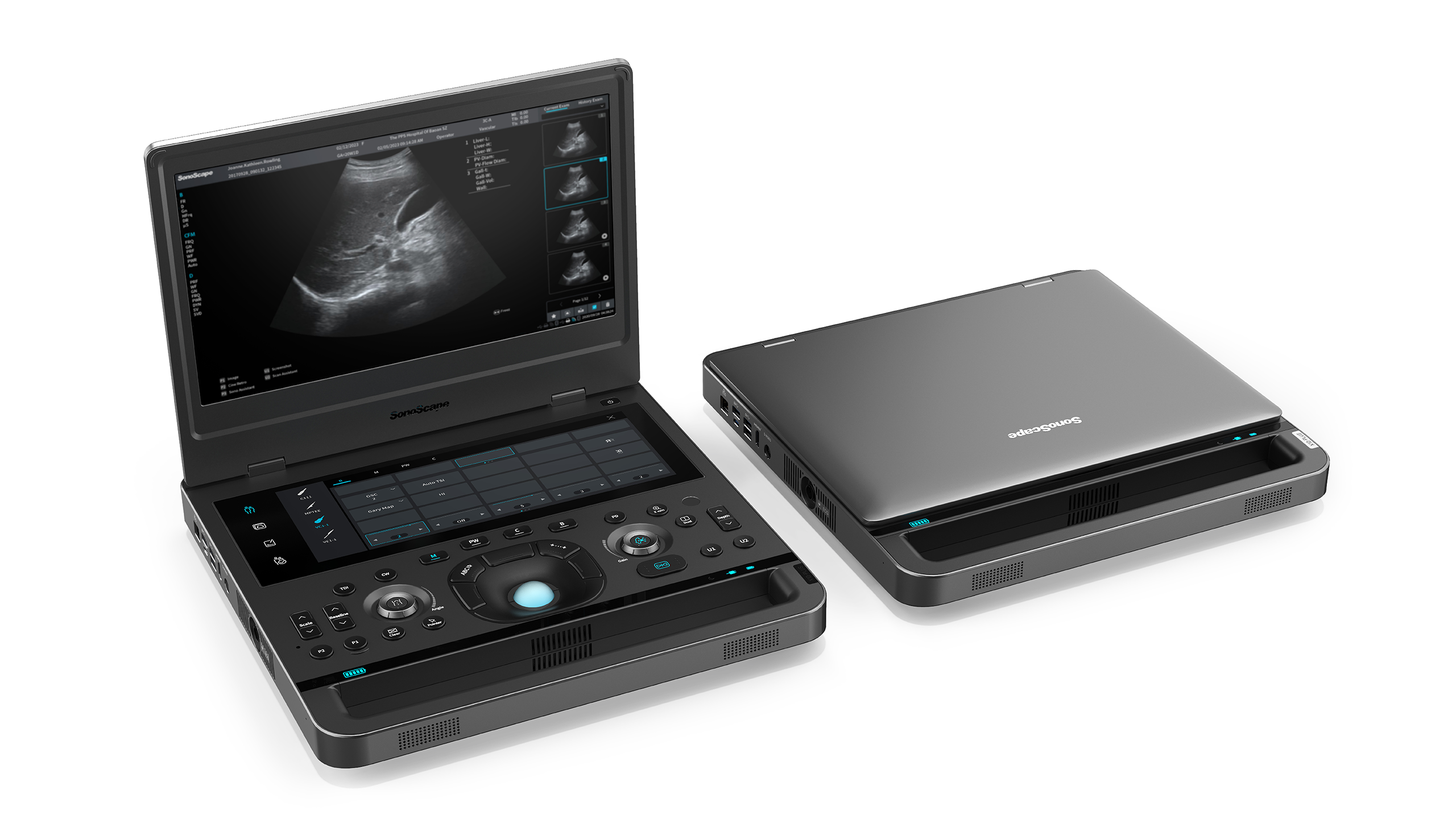 SonoScape Portable Ultrasound X-Series