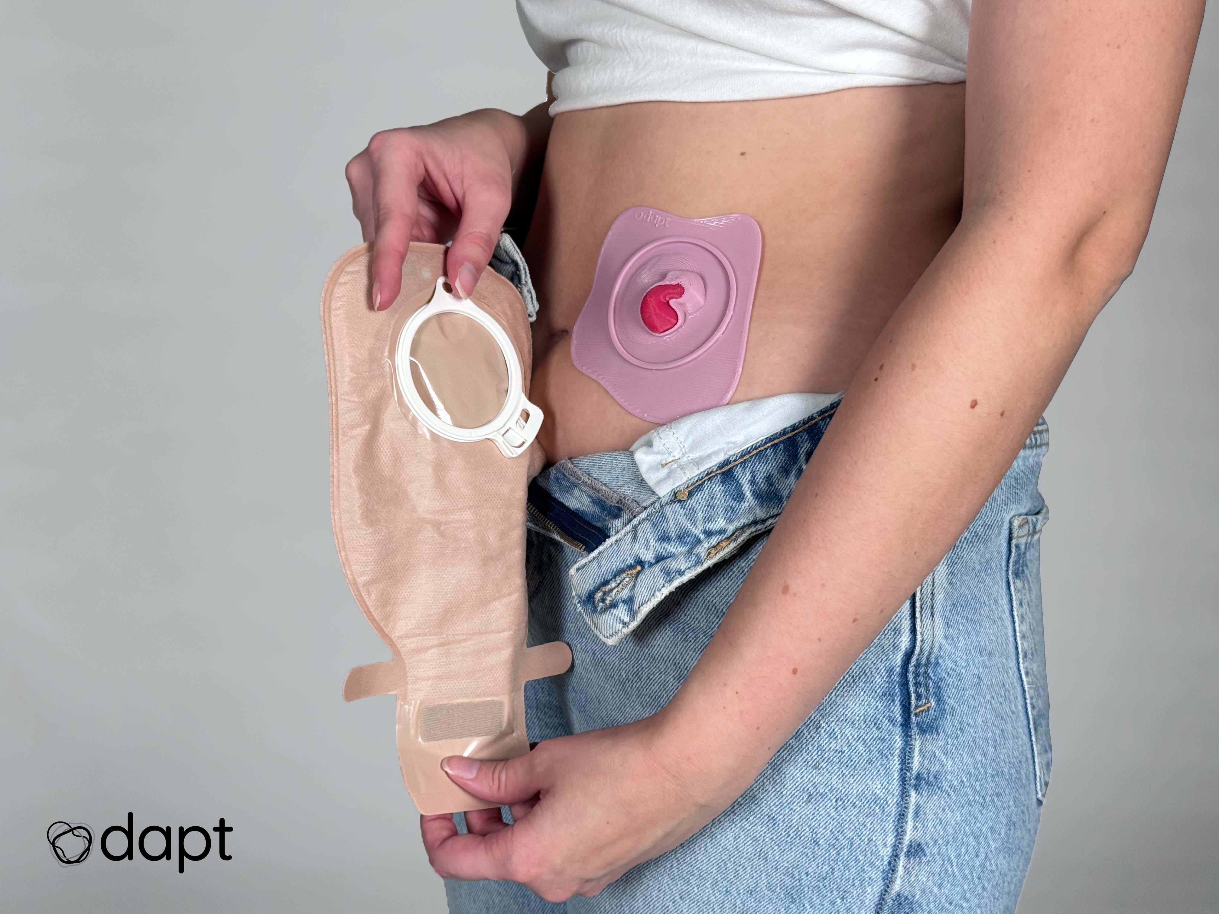 Odapt - Transforming the Ostomy Bag Experience