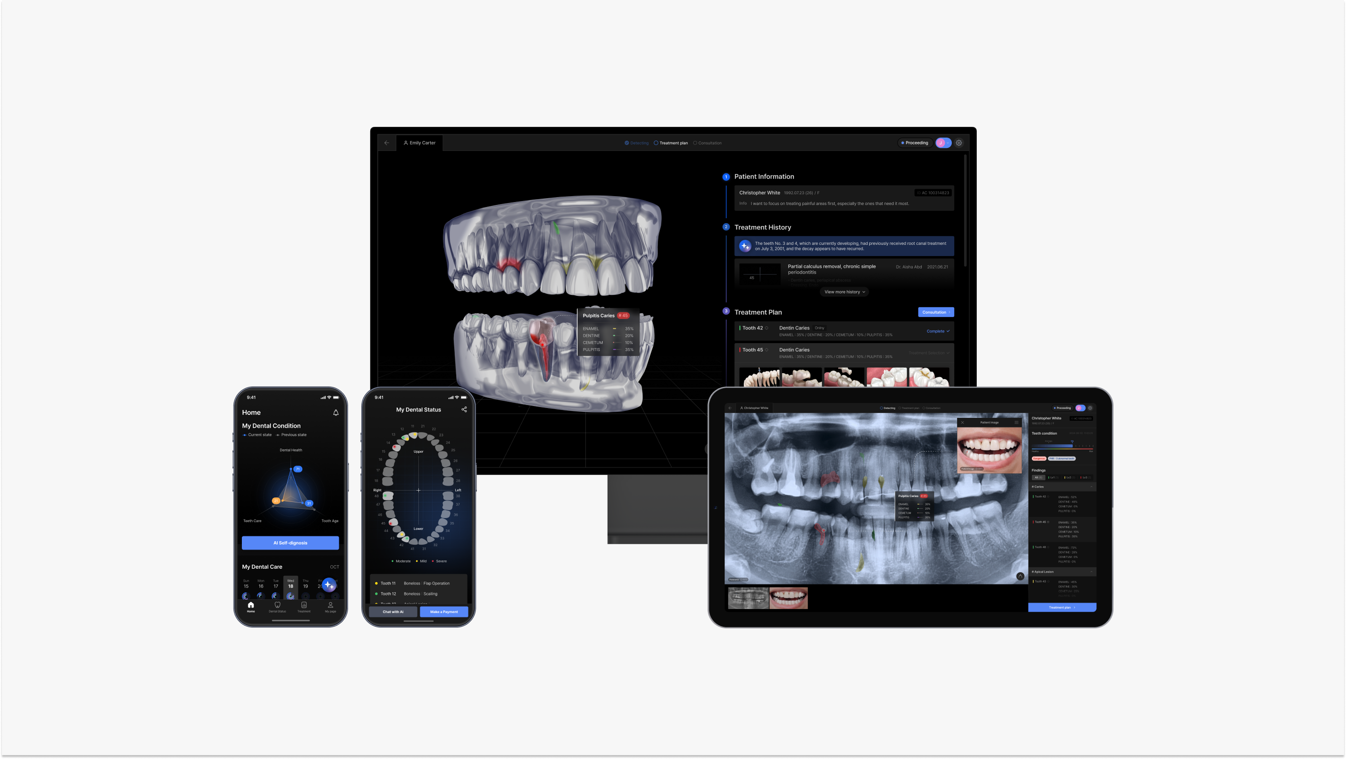 PANO - Dental AI-Based Diagnosis Aid platform