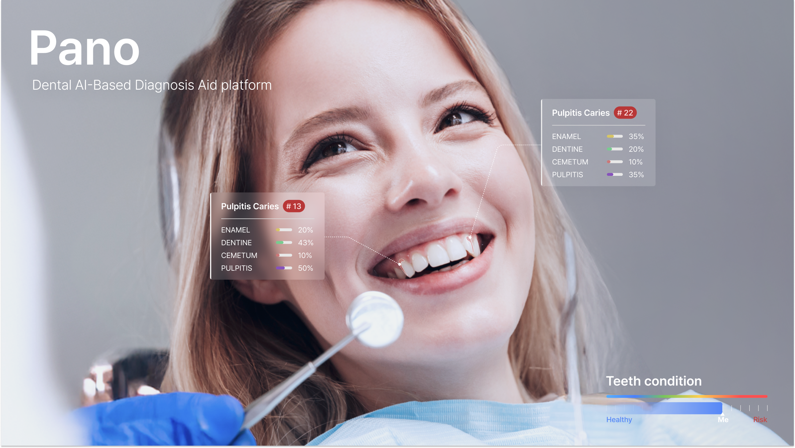 PANO - Dental AI-Based Diagnosis Aid platform