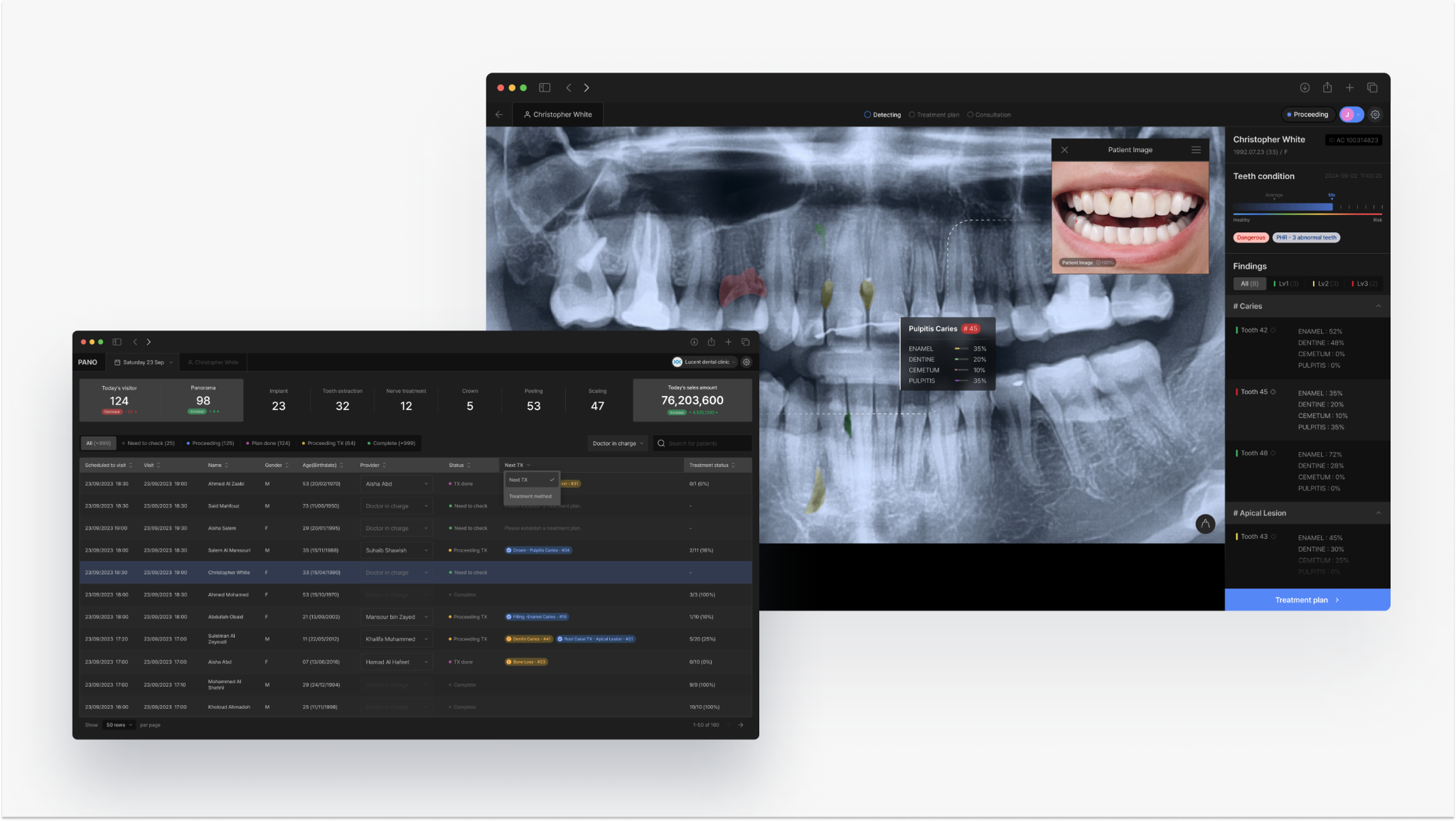 PANO - Dental AI-Based Diagnosis Aid platform