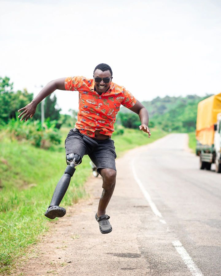 Circleg - Accessible Prosthetics for All