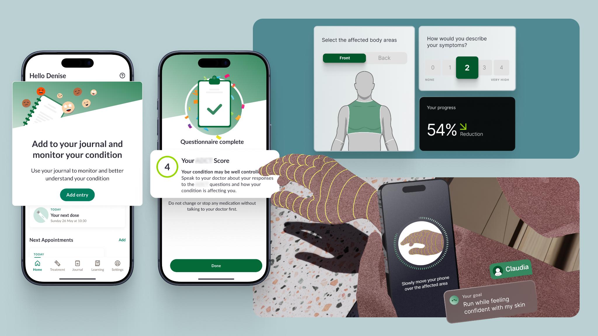 Connected Disease Management