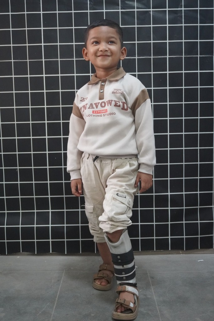 Made to Fit: Child centered prosthetic & orthotic