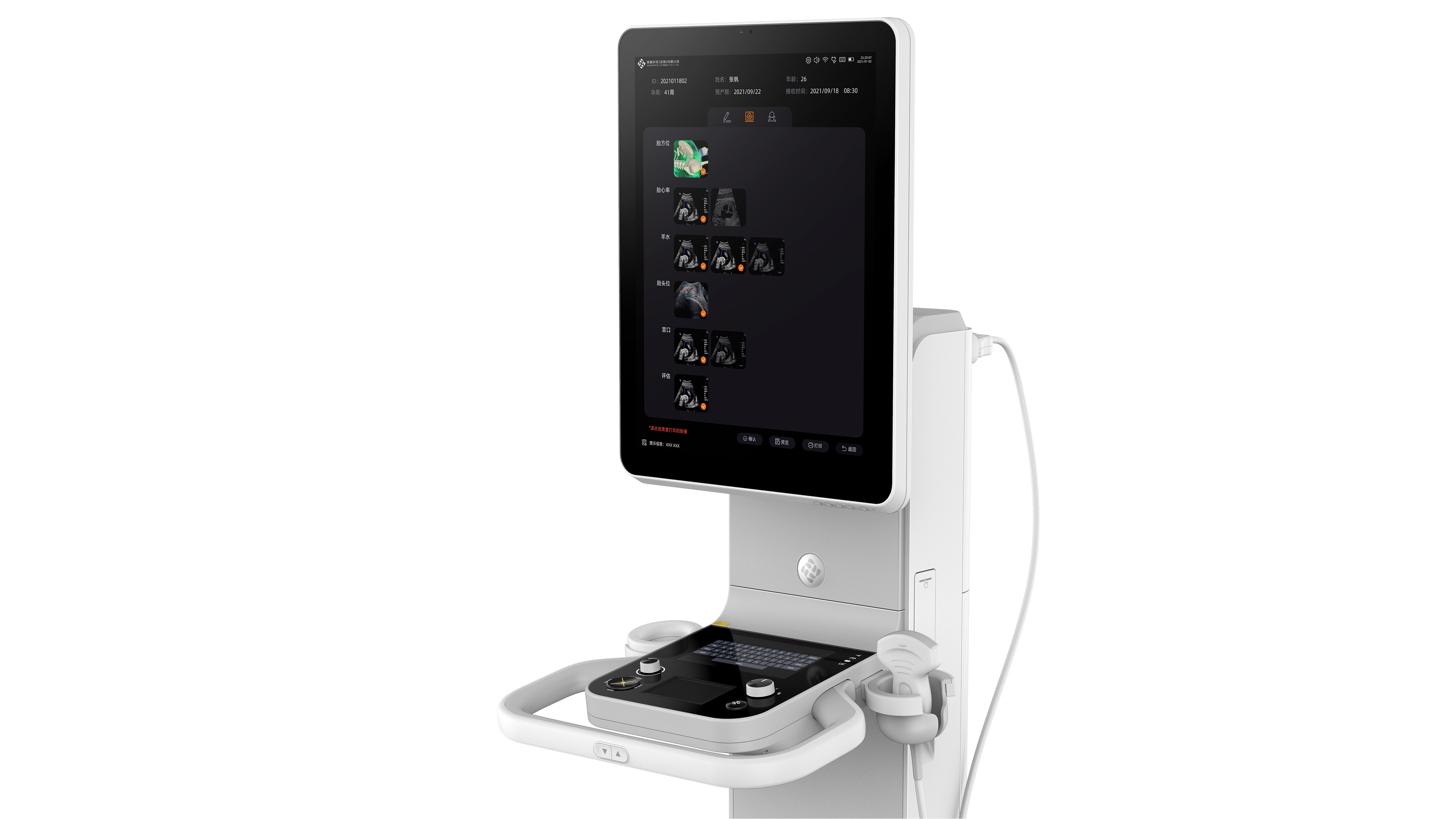 Gynecological delivery process monitoring system