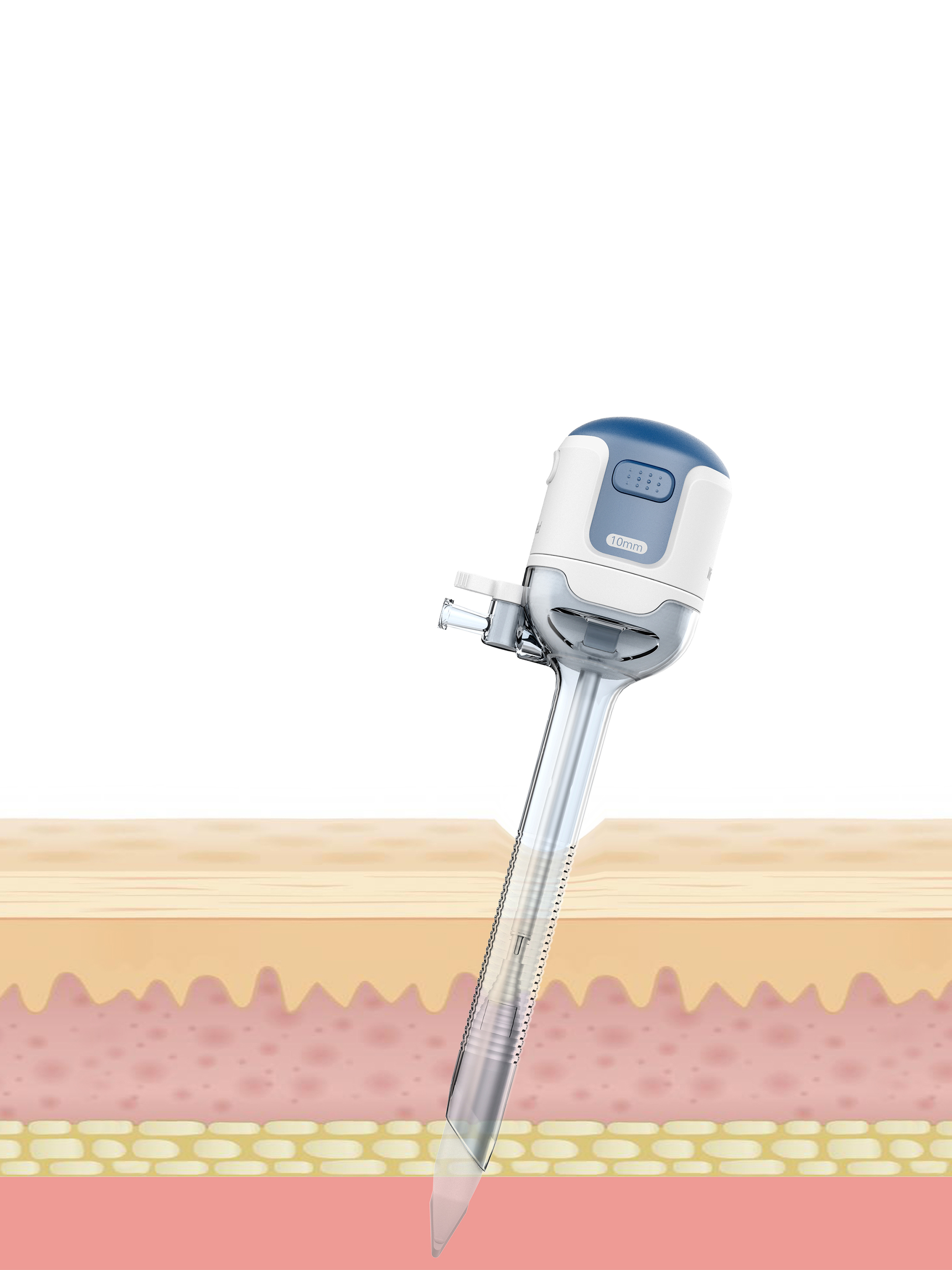 Disposable series laparoscopic Trocar