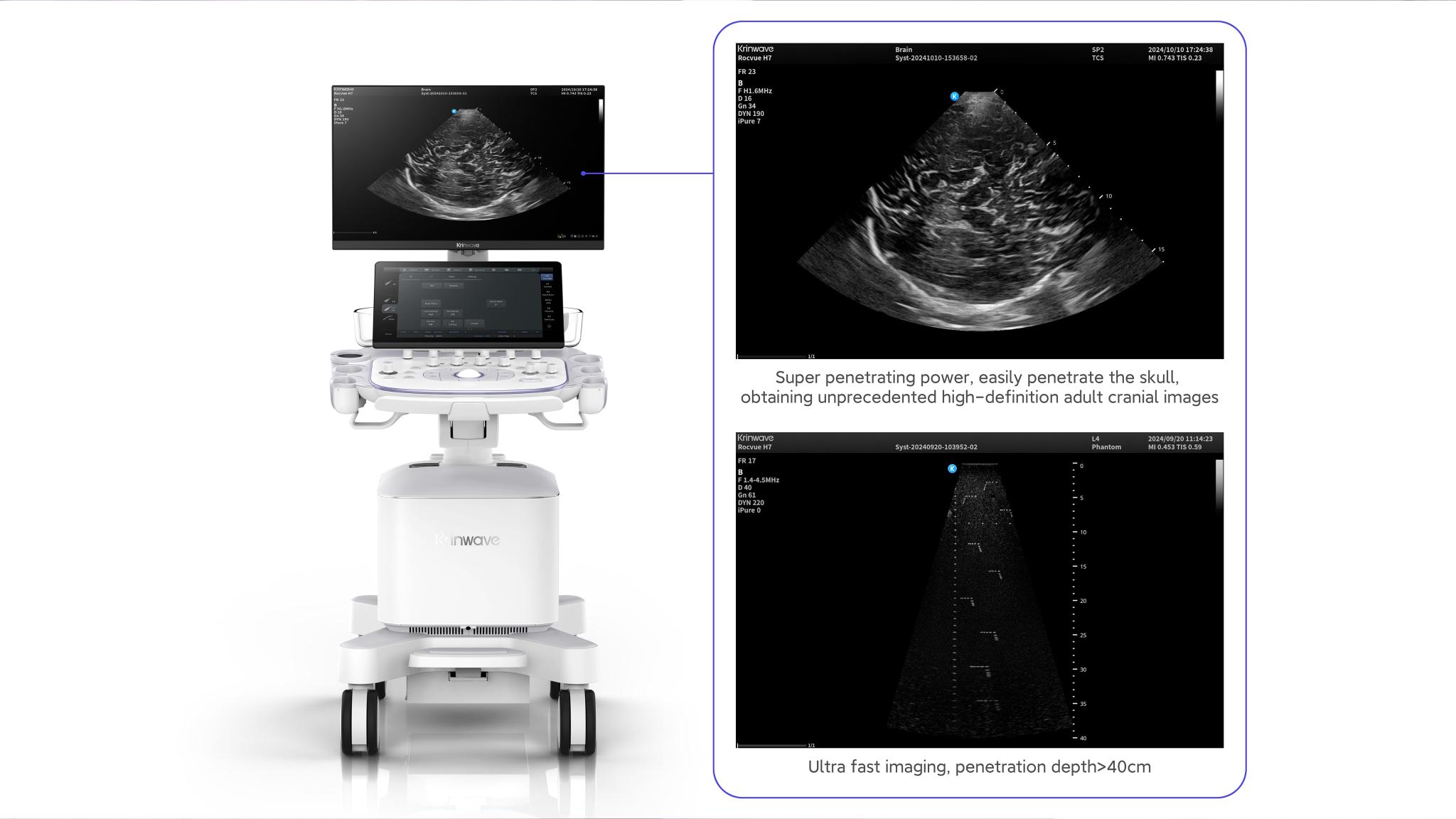 Rocvue T Ultrasound system