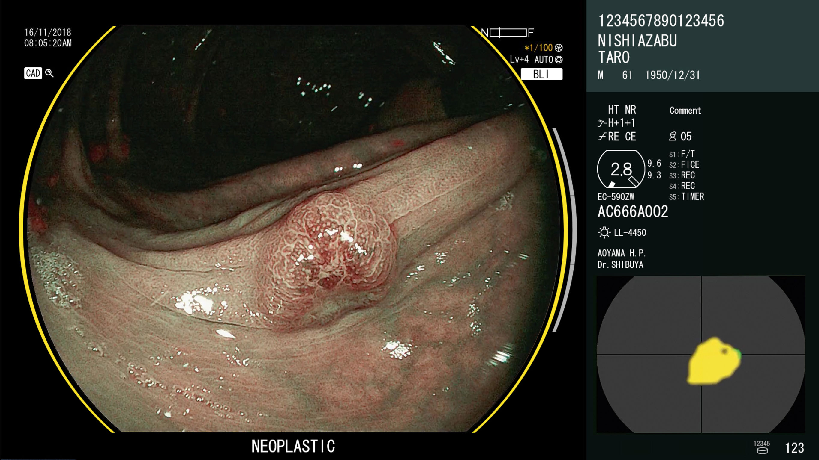 CAD EYE (EW10-EC02)