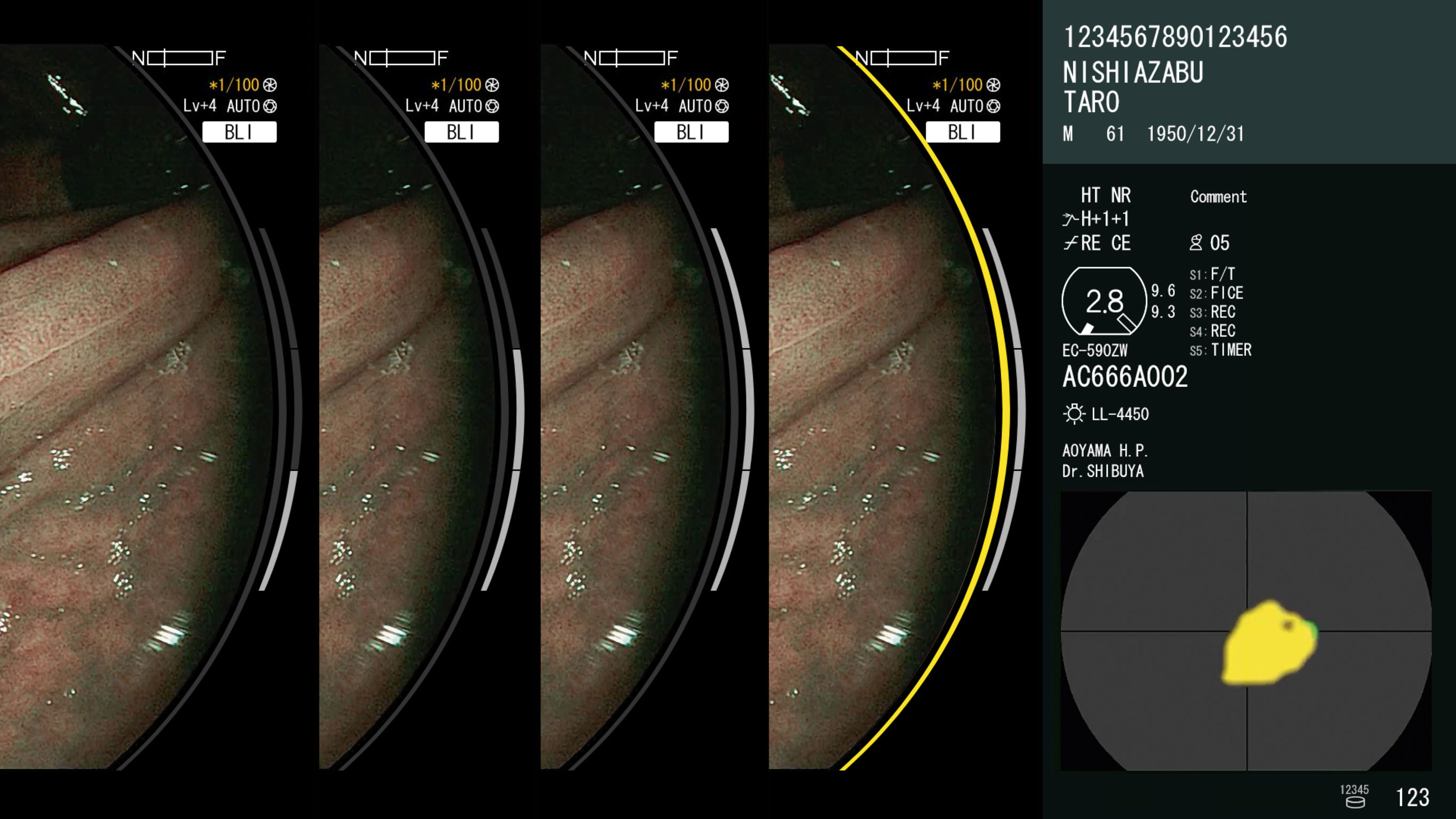 CAD EYE (EW10-EC02)