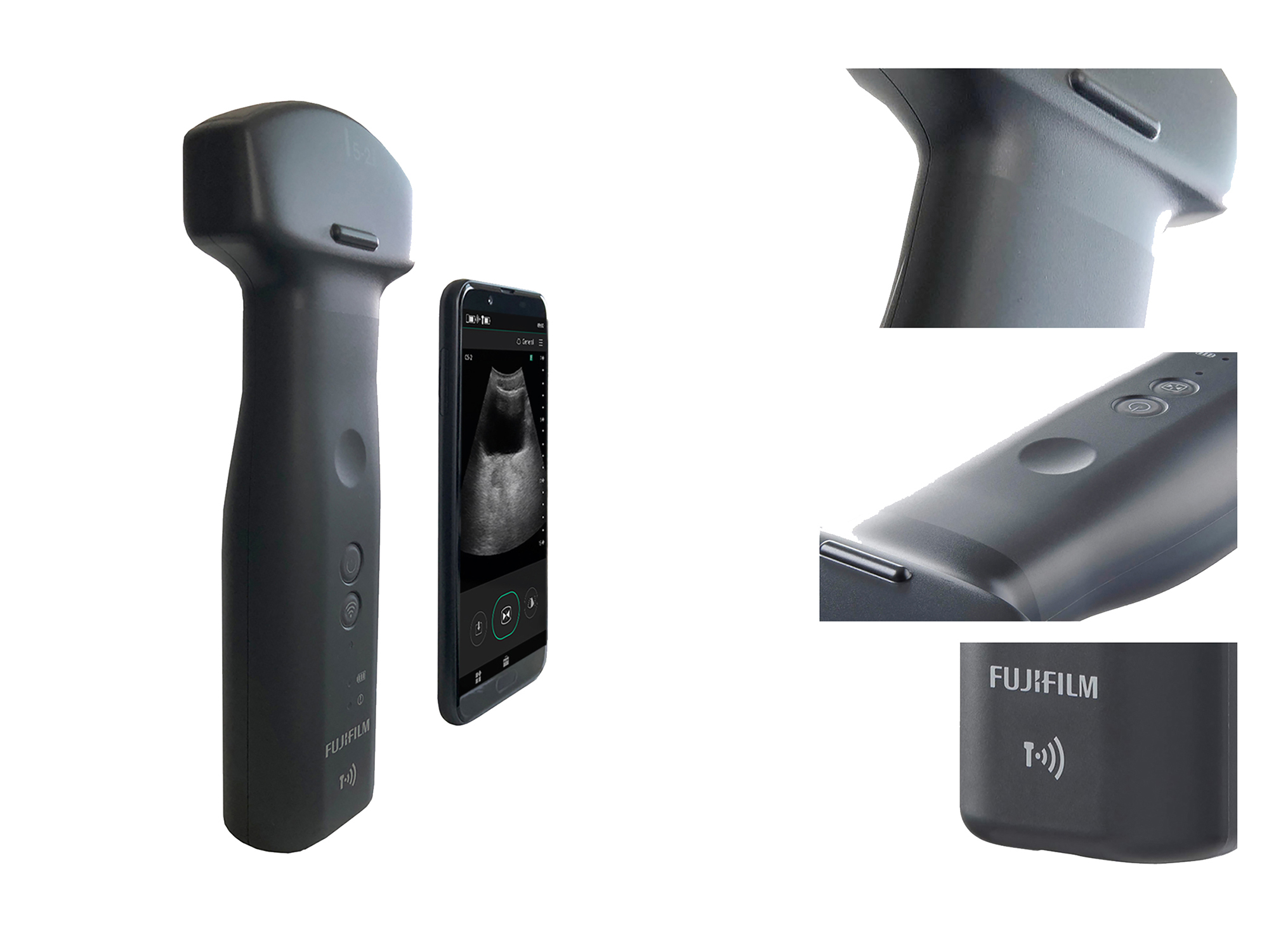 iViz wireless (Automatic bladder volume measurement)