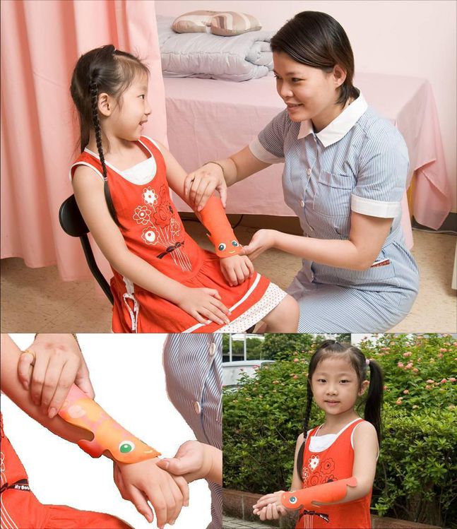 Colorchanging splint