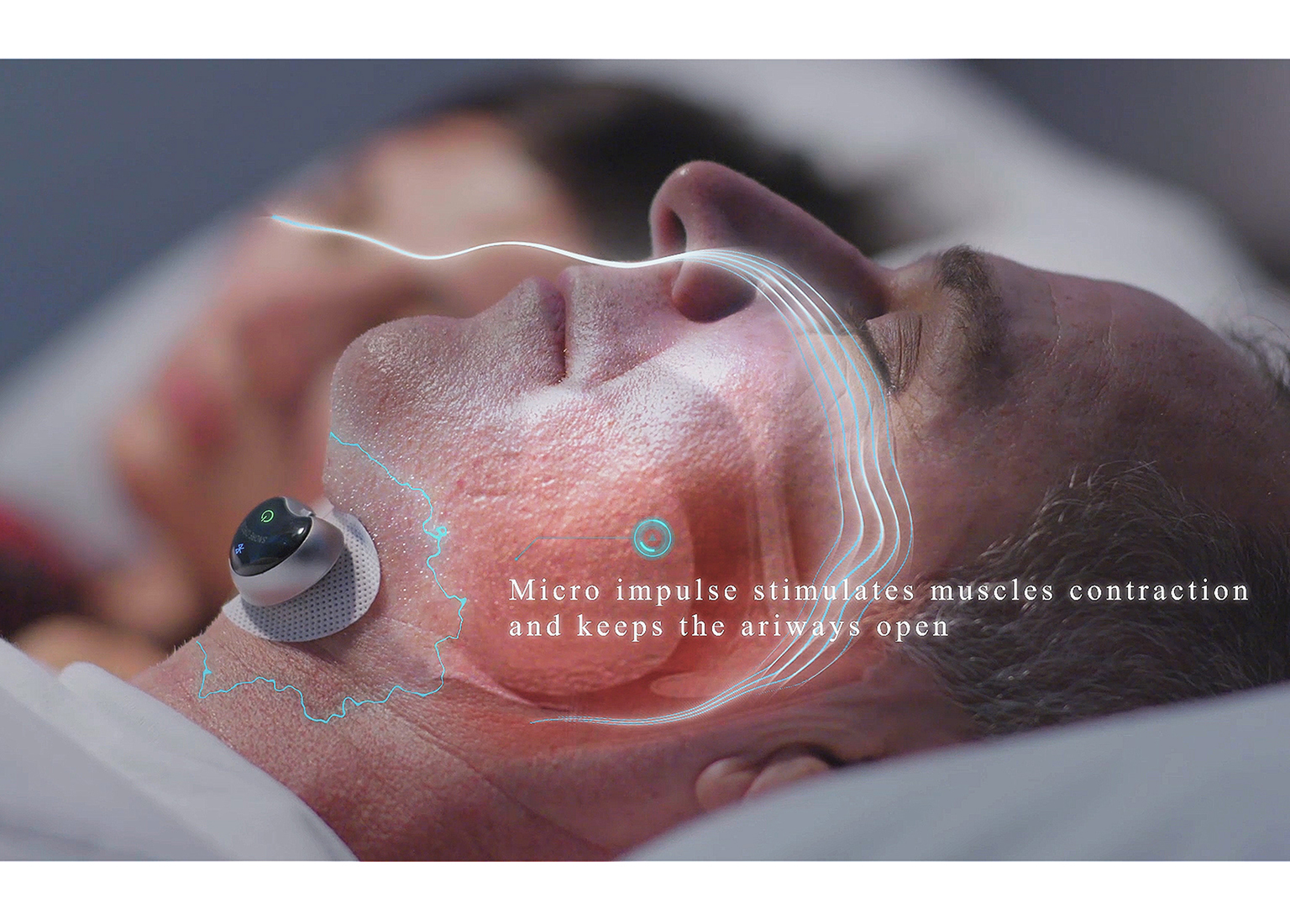 Smart Anti-Snore Electronic Muscle Stimulator