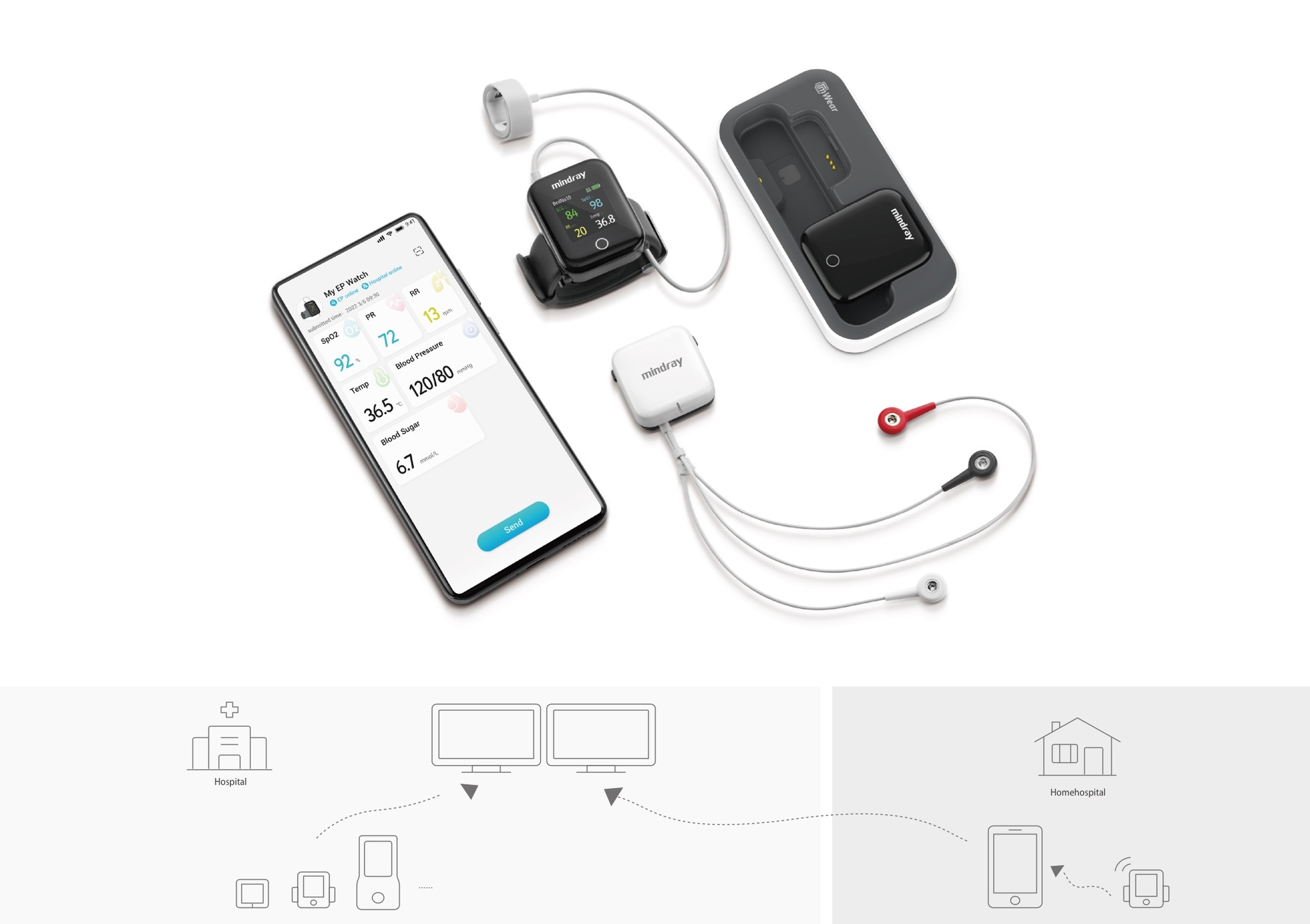mWear wearable patient monitoring system