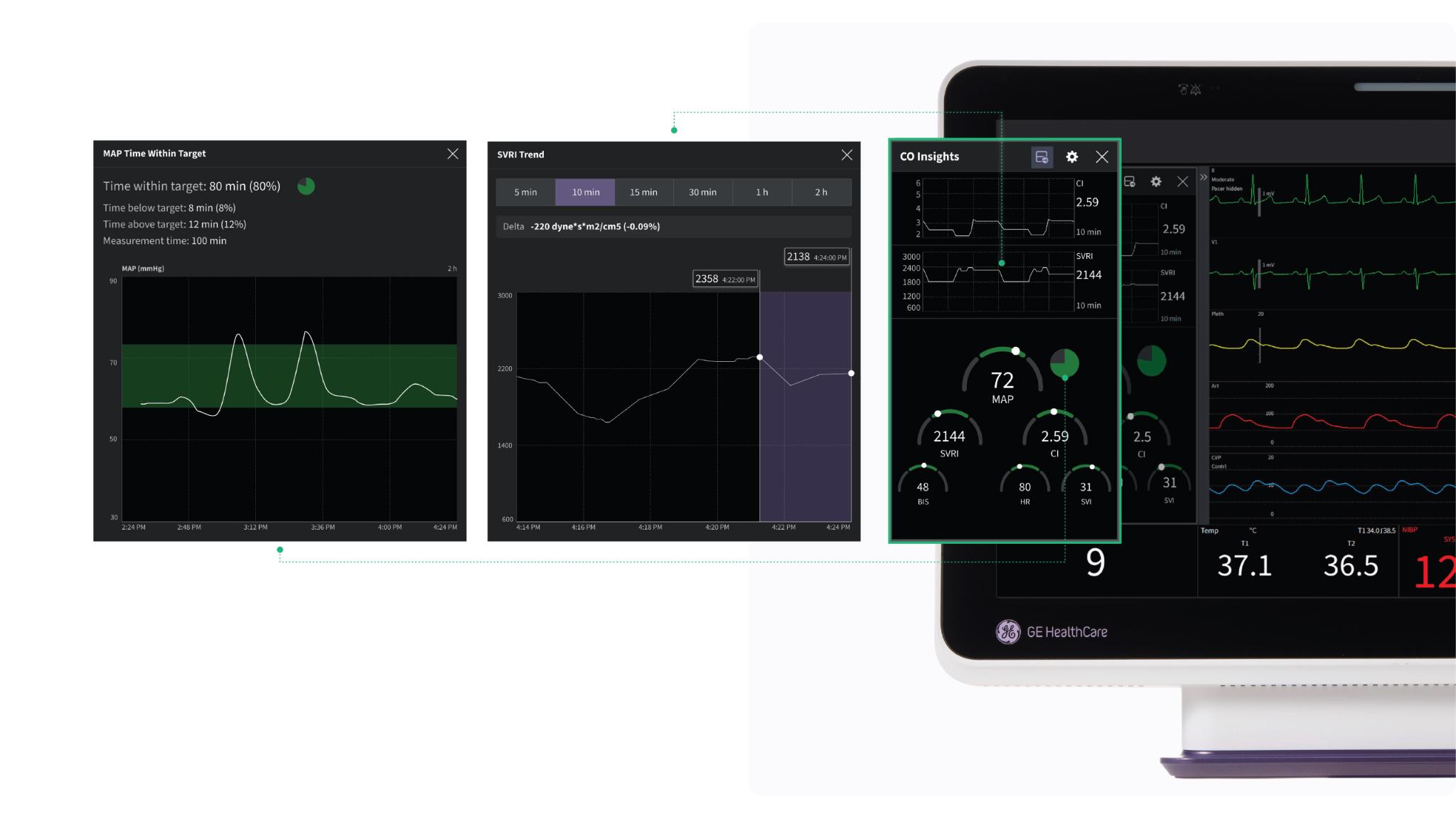 Carevance Patient Monitor