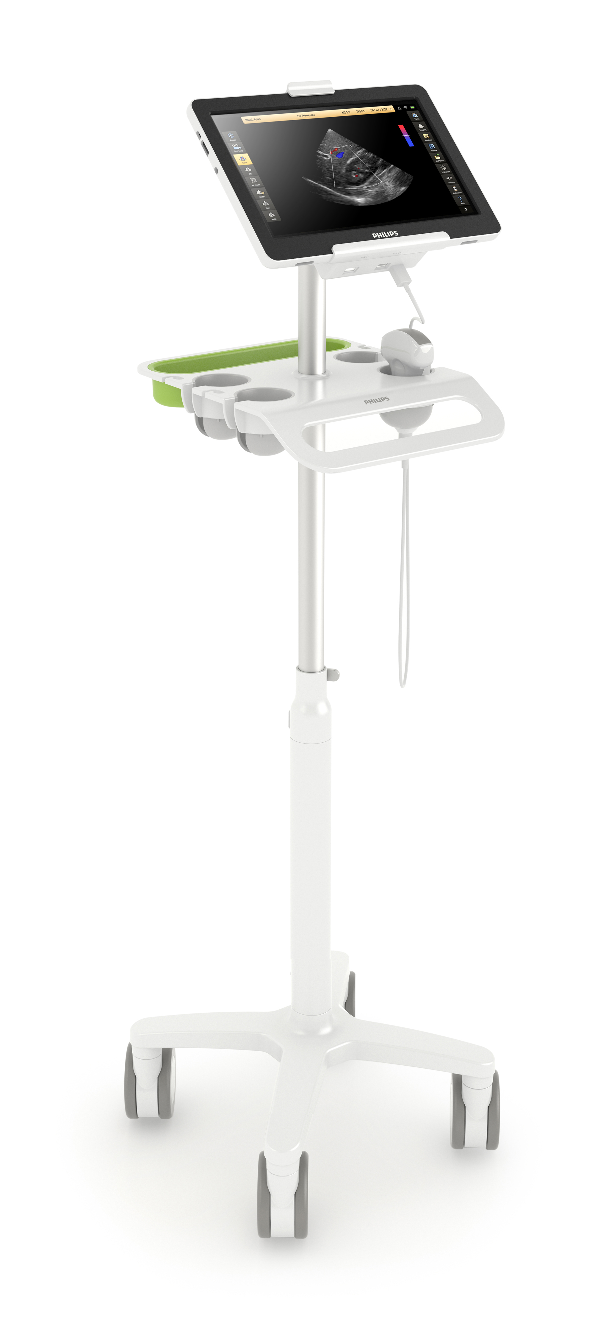 VISIQ portable ultrasound system