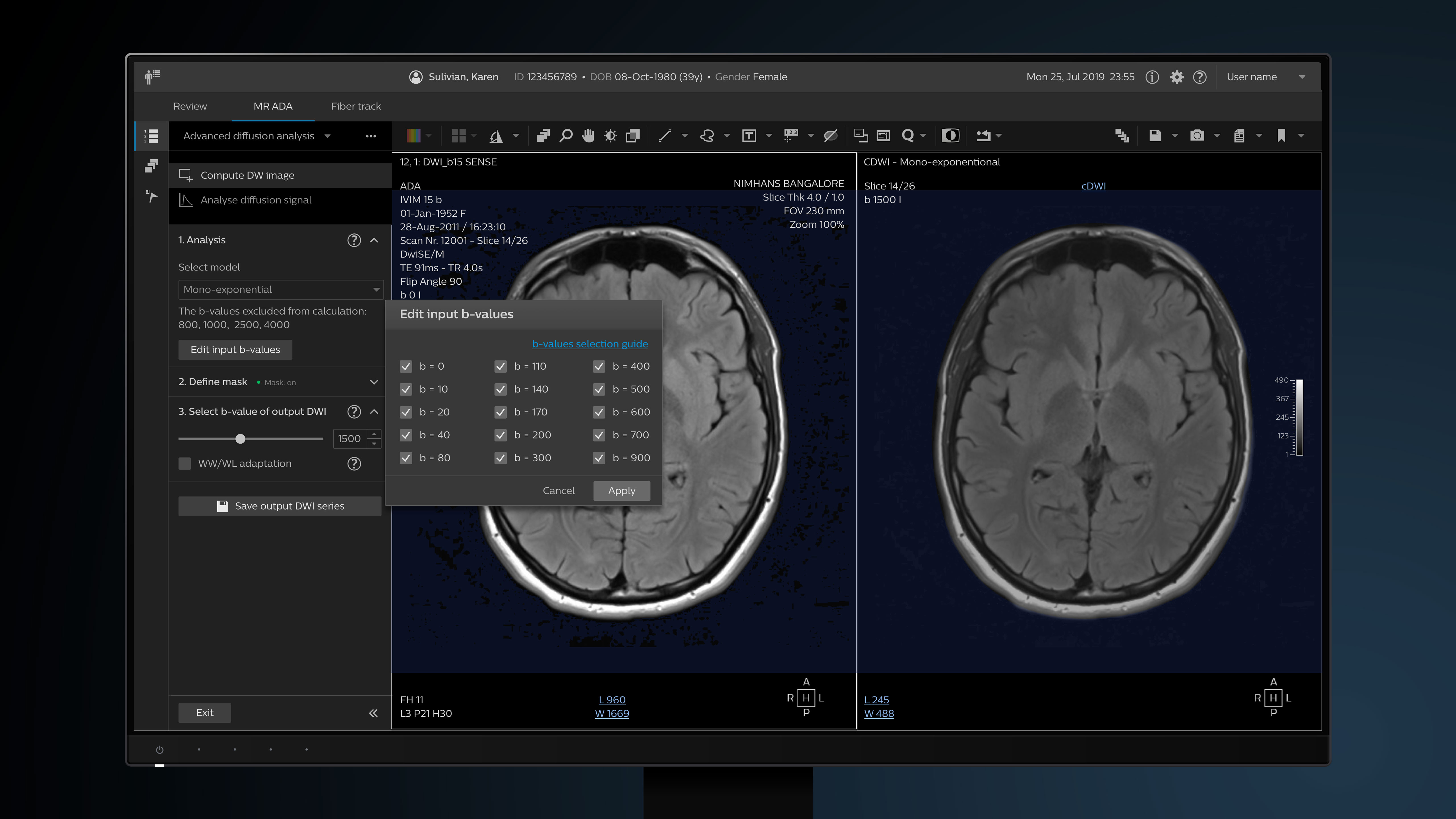 Philips IntelliSpace Portal MR