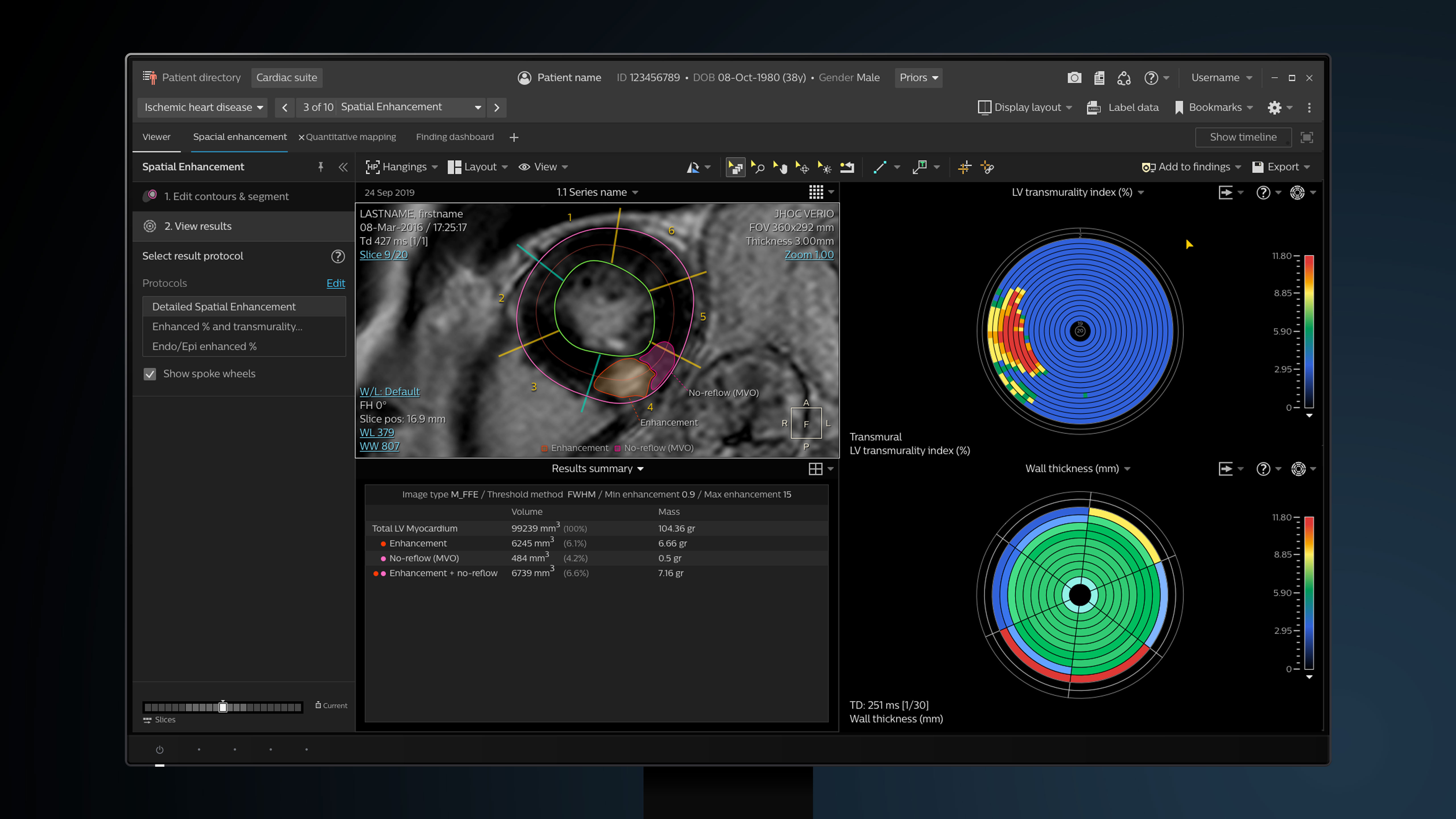 Philips IntelliSpace Portal Cardiac MR Suite