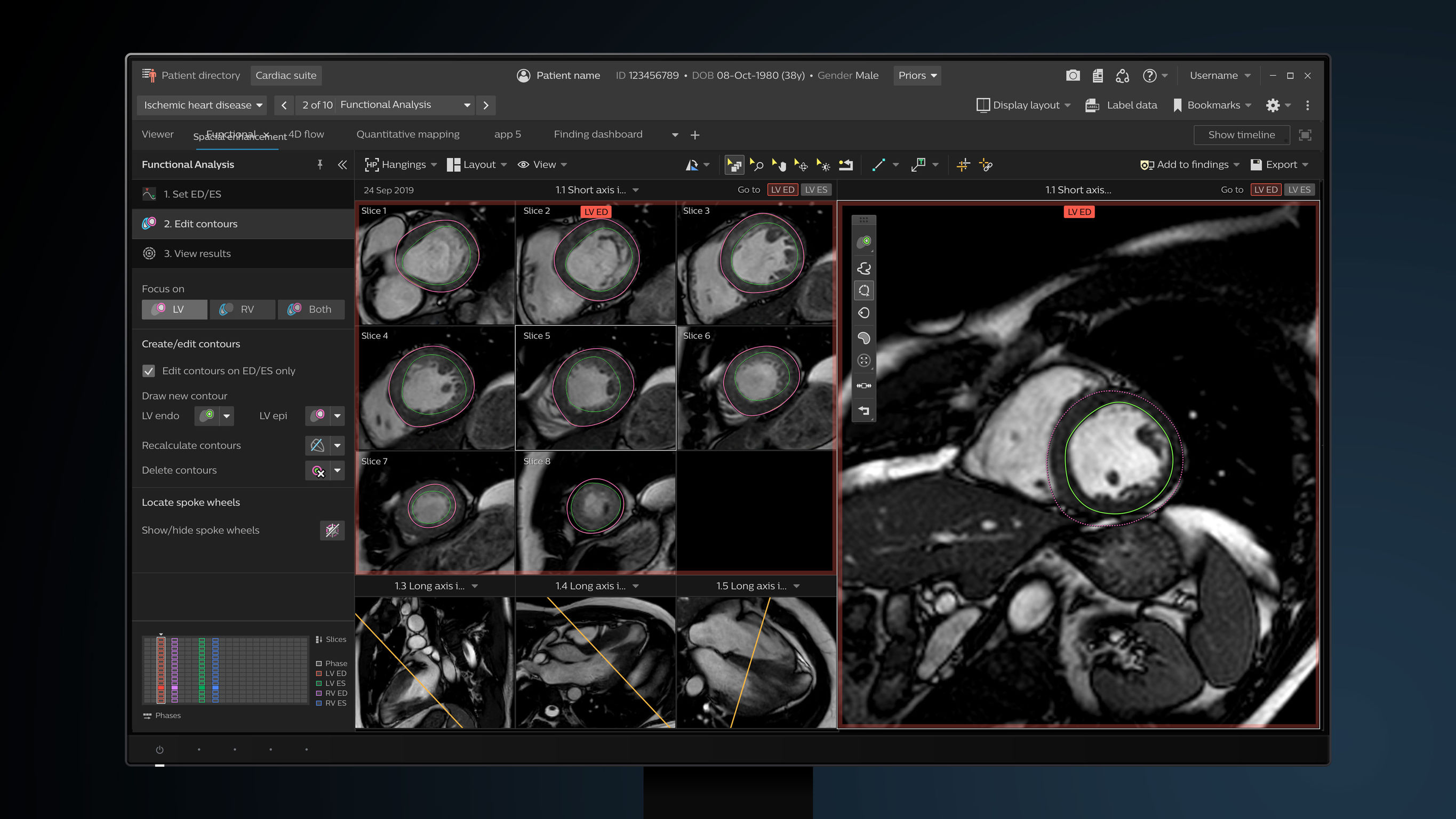 Philips IntelliSpace Portal Cardiac MR Suite