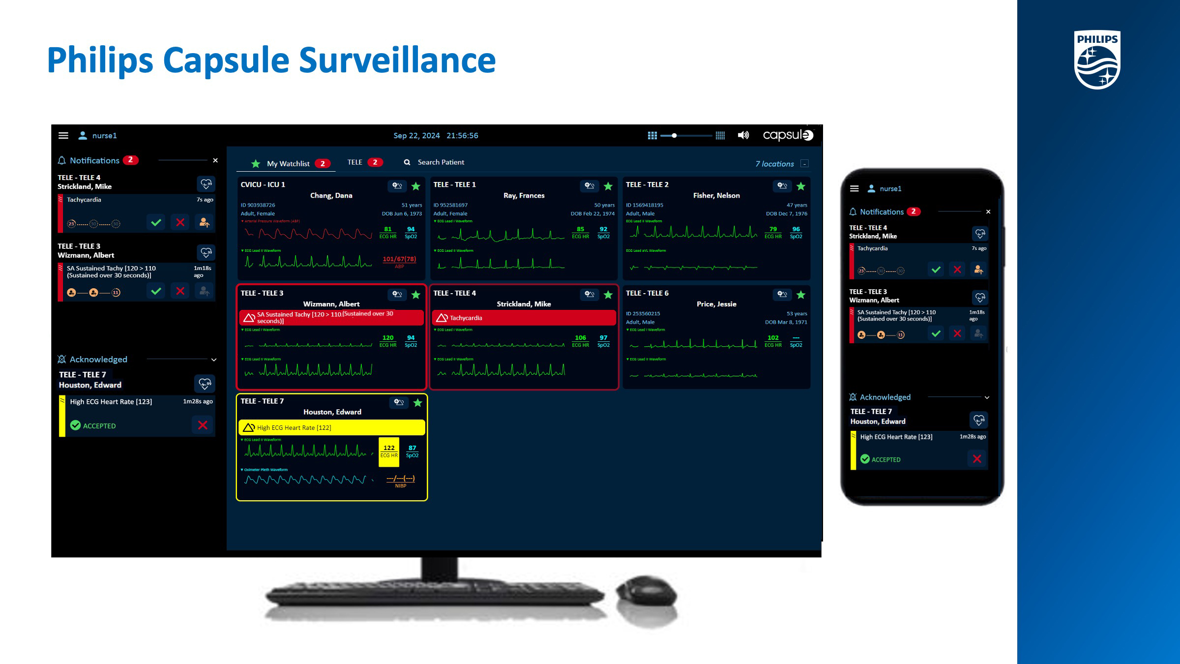 Philips Capsule Surveillance