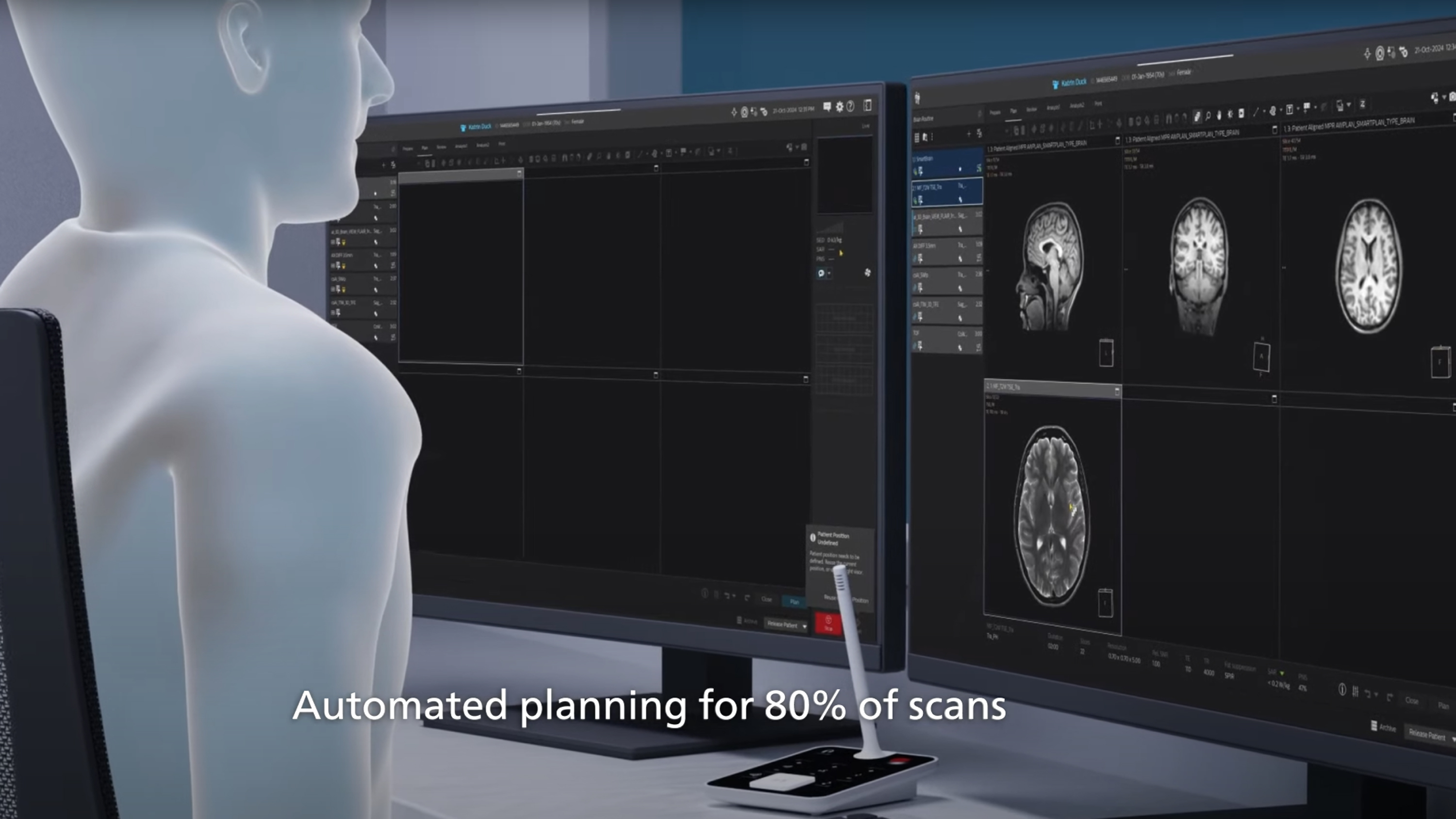 Philips MR Workspace R12 with SmartReading