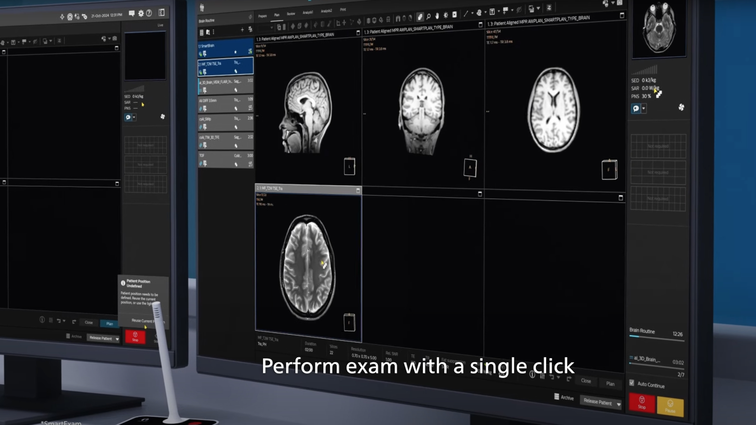 Philips MR Workspace R12 with SmartReading