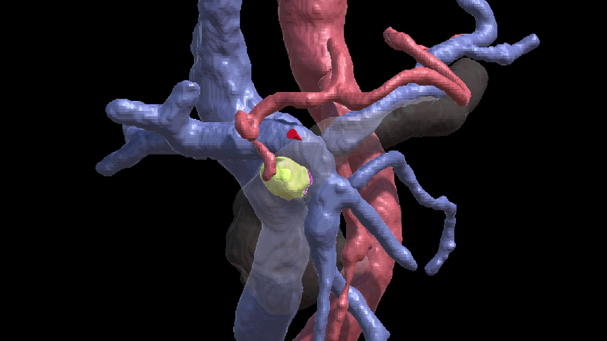 Advancing cancer care