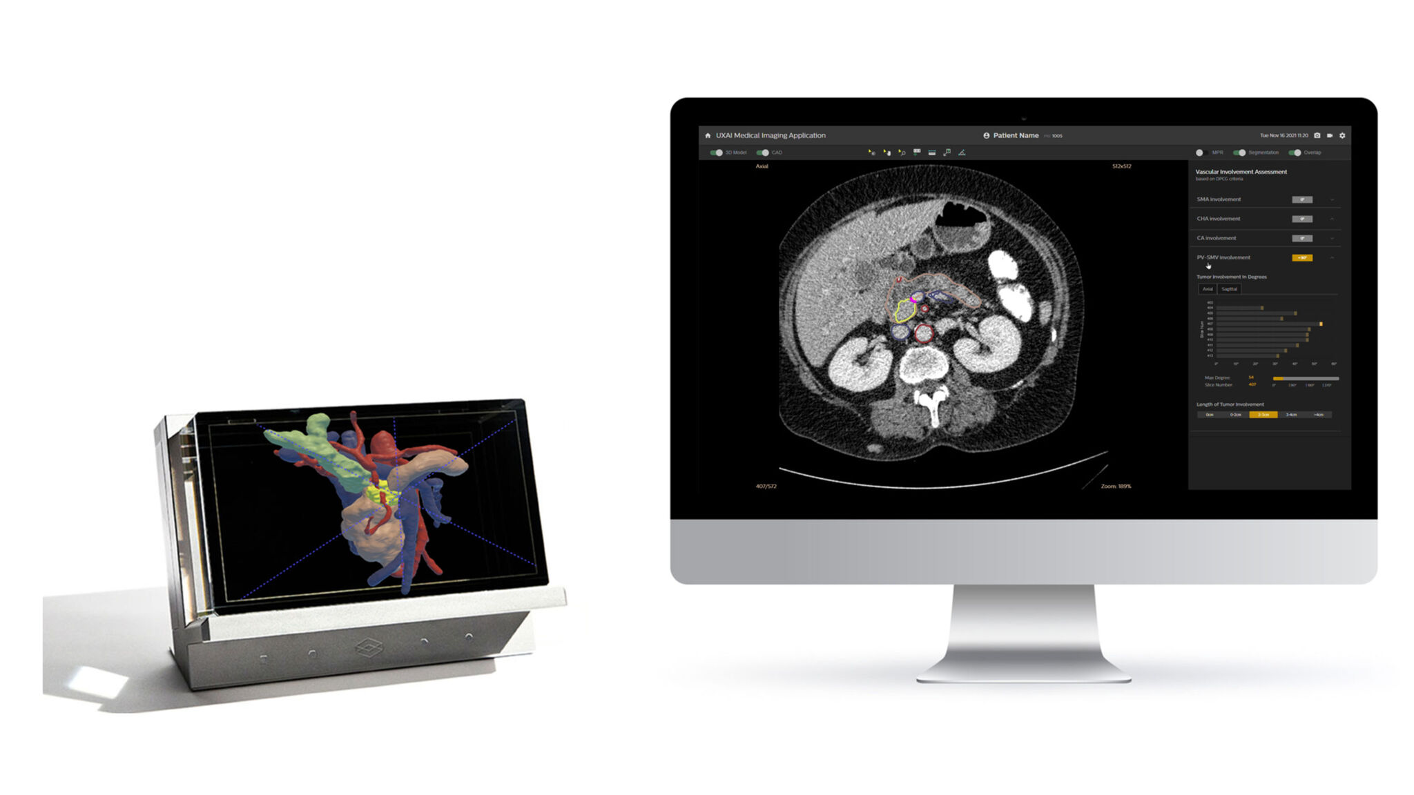 Advancing cancer care