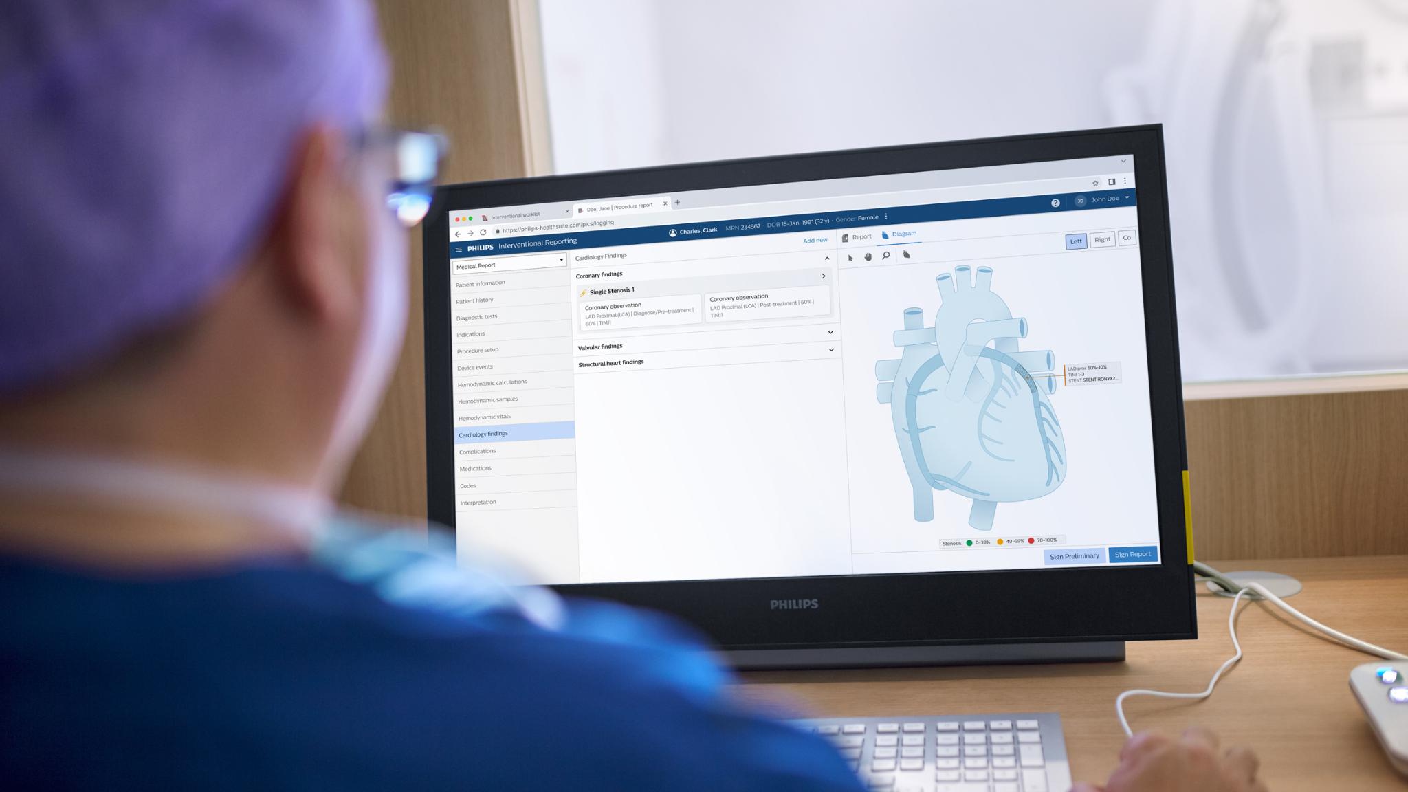 Philips Interventional Cardiology Reporting