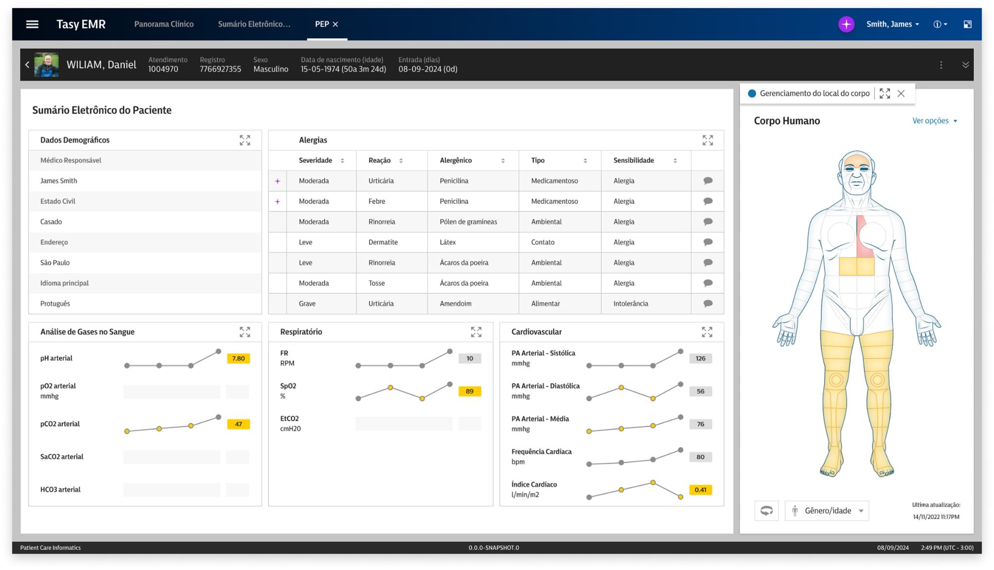Philips Precision Treatment Assistant