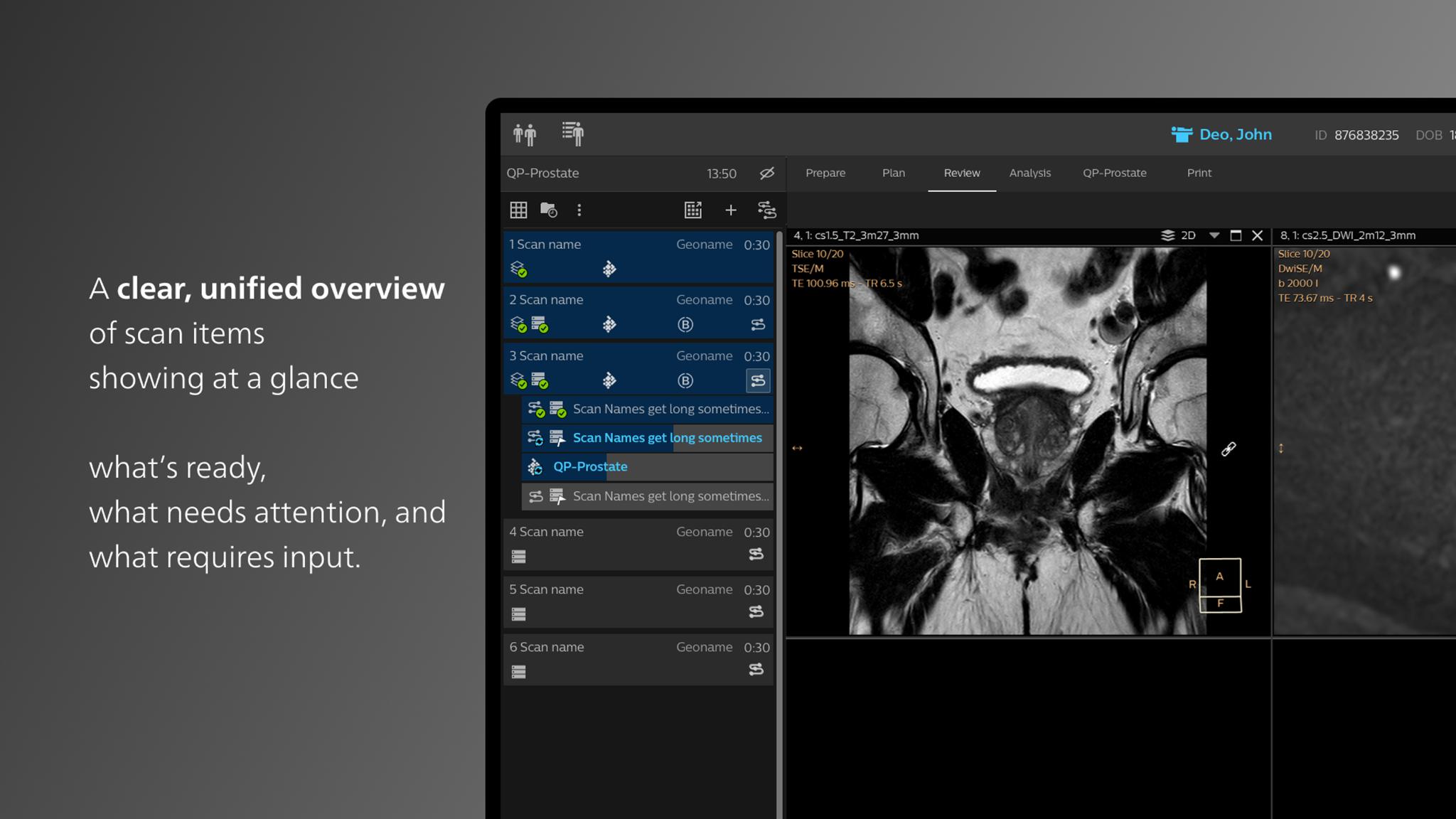 Philips MR Workspace R12 with SmartReading