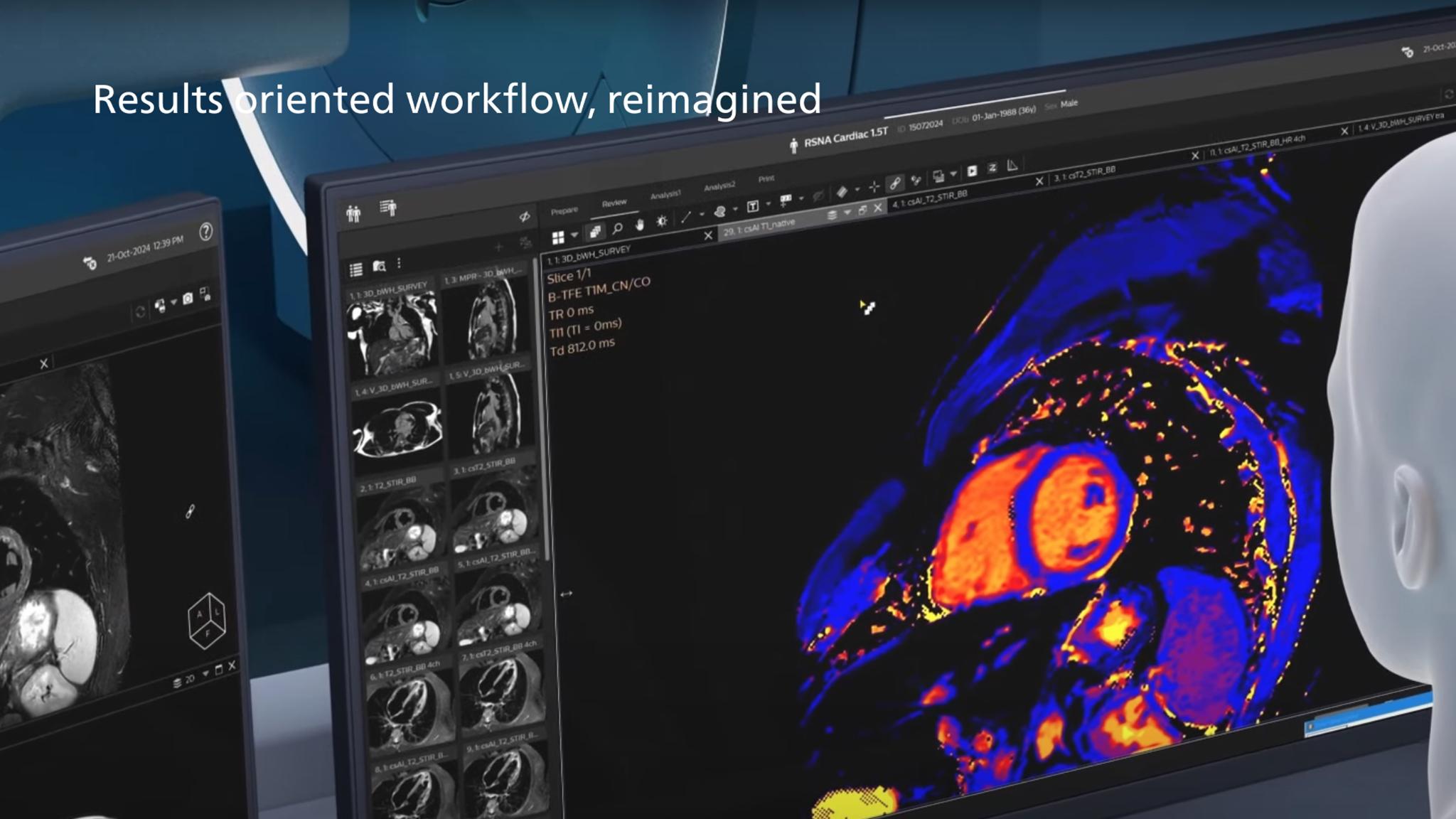 Philips MR Workspace R12 with SmartReading